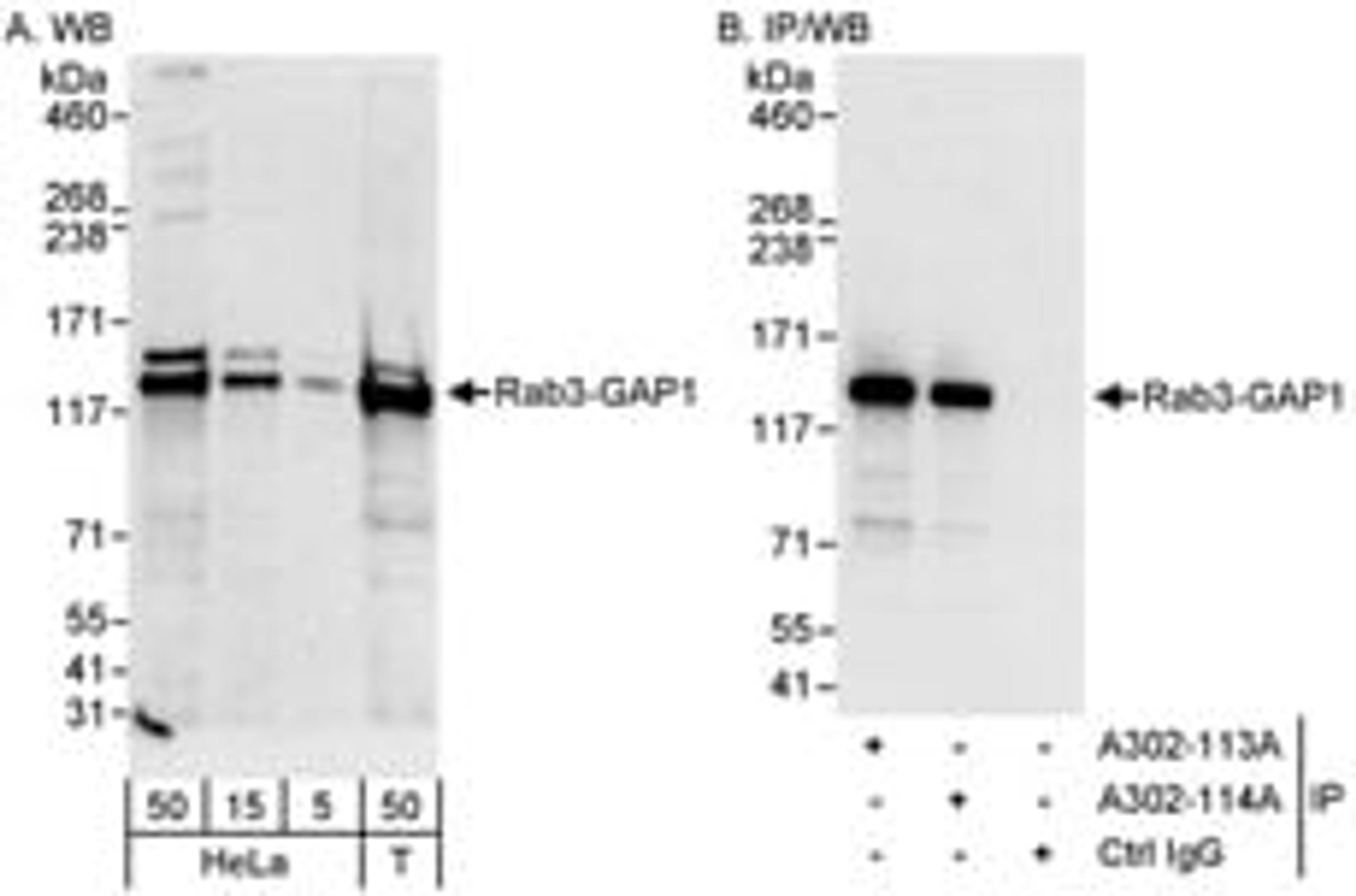 Detection of human Rab3-GAP1 by western blot and immunoprecipitation.