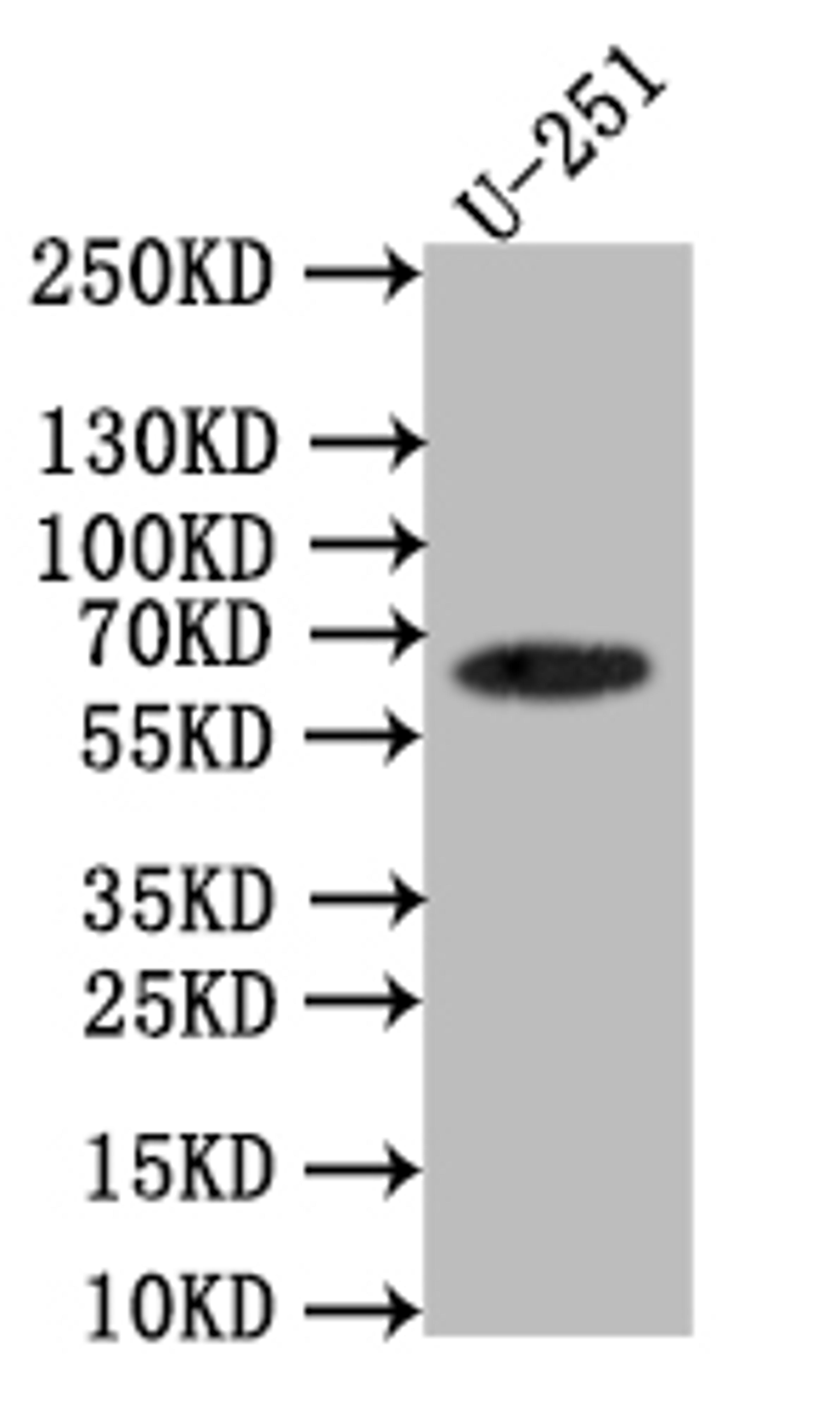 Western Blot. Positive WB detected in: U251 whole cell lysate. All lanes: EAAT2 antibody at 1:1000. Secondary. Goat polyclonal to rabbit IgG at 1/50000 dilution. Predicted band size: 62 kDa. Observed band size: 62 kDa. 
