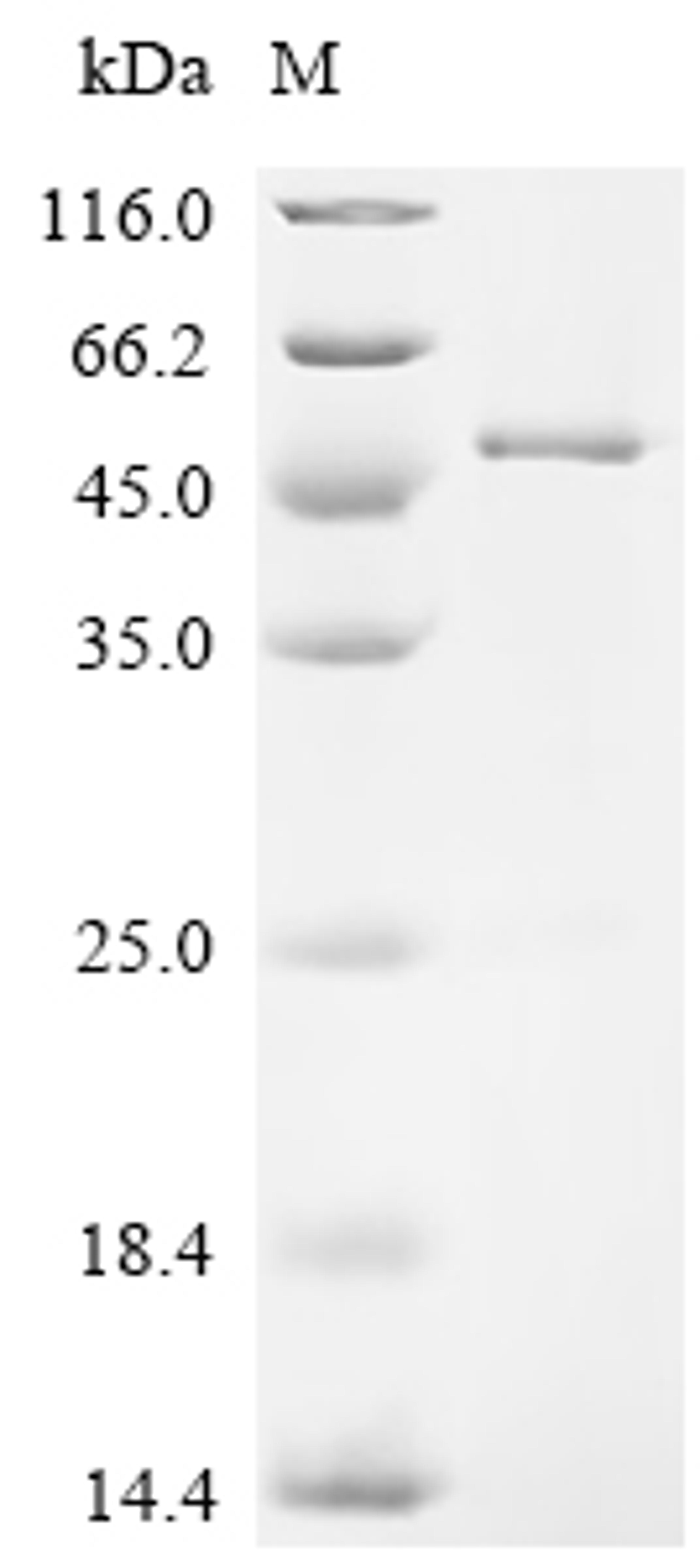 (Tris-Glycine gel) Discontinuous SDS-PAGE (reduced) with 5% enrichment gel and 15% separation gel.
