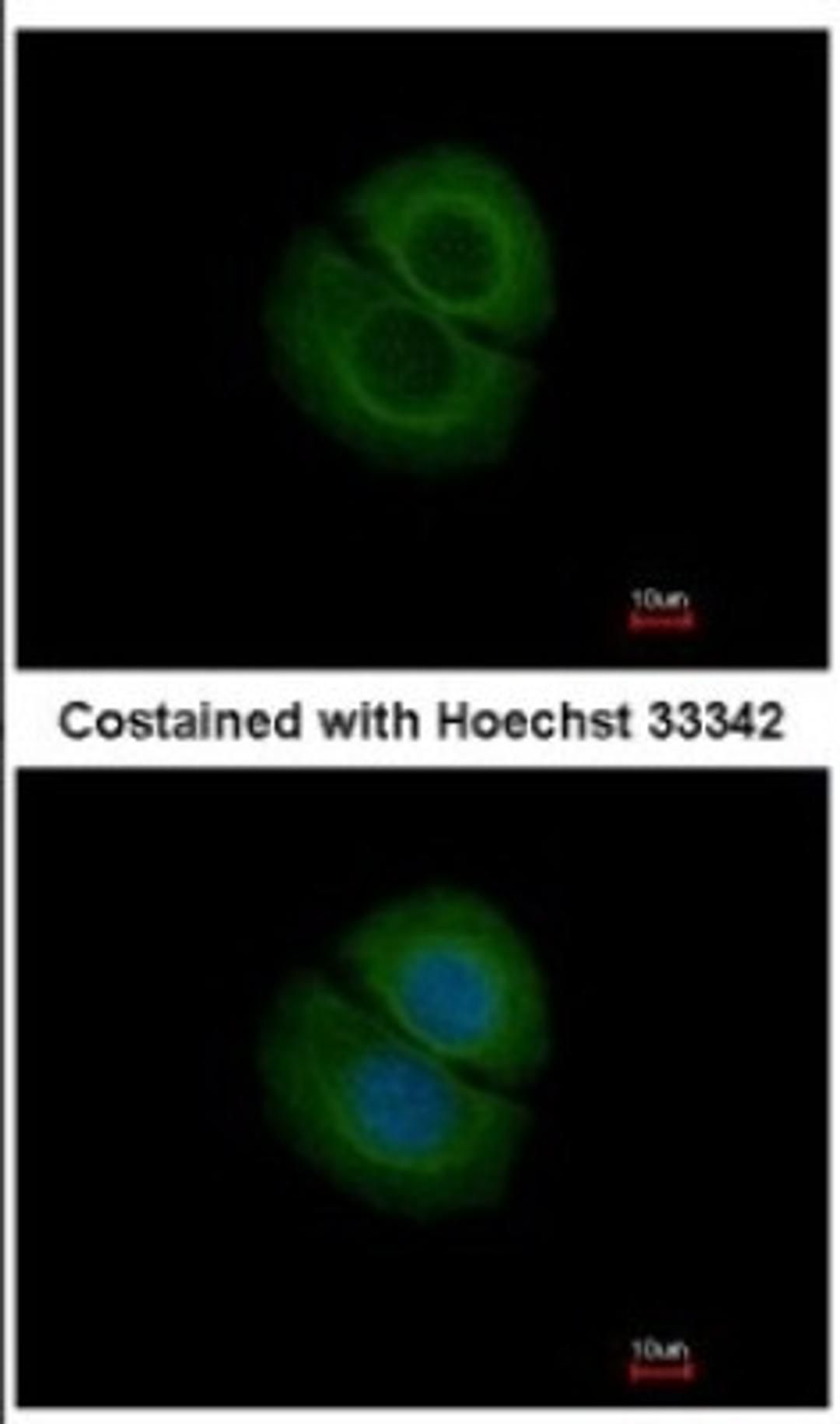 Immunocytochemistry/Immunofluorescence: Coronin-2B Antibody [NBP2-15969] - Immunofluorescence analysis of methanol-fixed MCF-7, using antibody at 1:200 dilution.