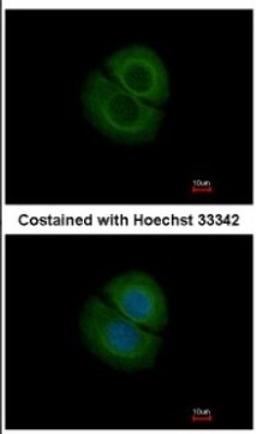 Immunocytochemistry/Immunofluorescence: Coronin-2B Antibody [NBP2-15969] - Immunofluorescence analysis of methanol-fixed MCF-7, using antibody at 1:200 dilution.