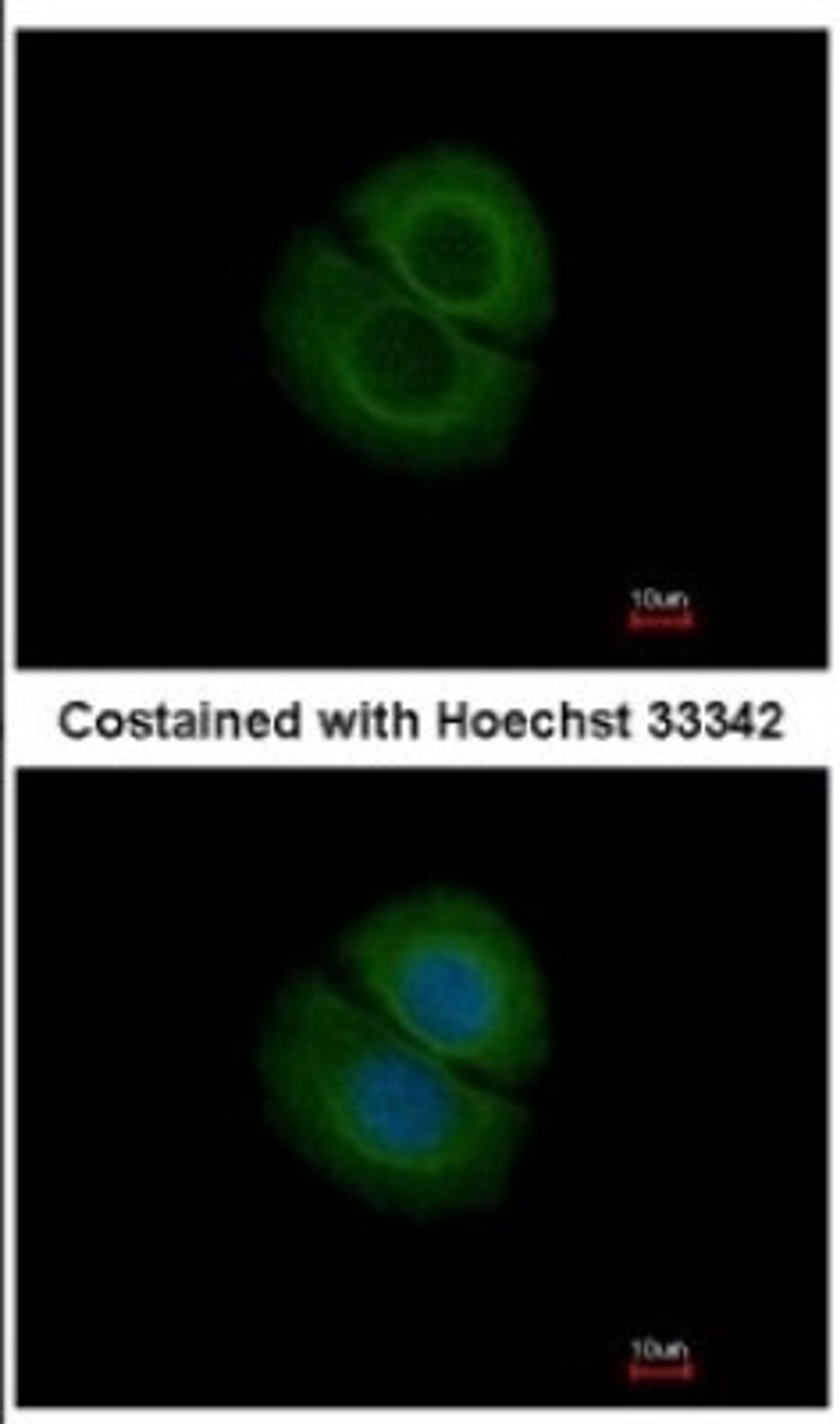 Immunocytochemistry/Immunofluorescence: Coronin-2B Antibody [NBP2-15969] - Immunofluorescence analysis of methanol-fixed MCF-7, using antibody at 1:200 dilution.