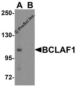 Western blot analysis of BCLAF1 in human brain tissue lysate with BCLAF1 antibody at 1 μg/ml.