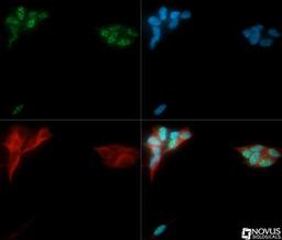 Immunocytochemistry/Immunofluorescence: AlphaB Crystallin/CRYAB Antibody [NB100-2520] - CRYAB antibody was tested in SHSH5Y cells with DyLight488 (green). Nuclei and alpha-tubulin were counterstained with DAPI (blue) and Dylight 550 (red).