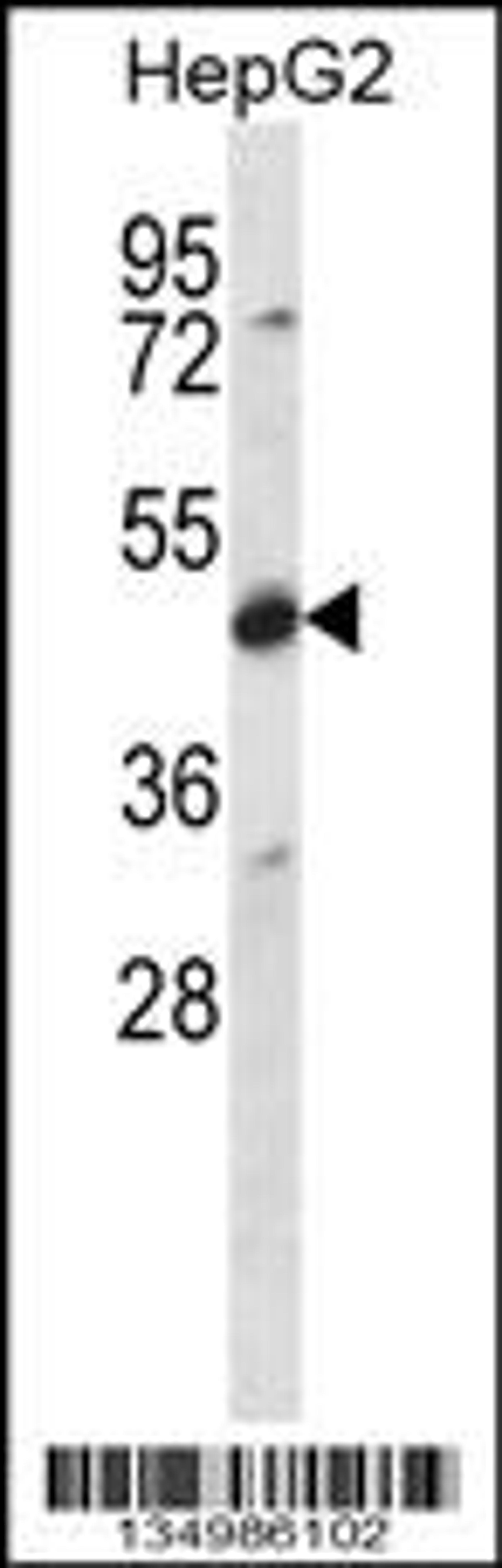 Western blot analysis in HepG2 cell line lysates (35ug/lane).