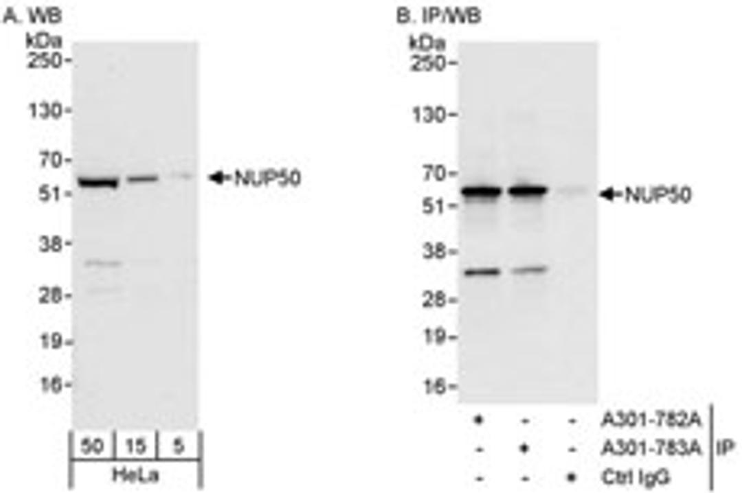 Detection of human NUP50 by western blot and immunoprecipitation.