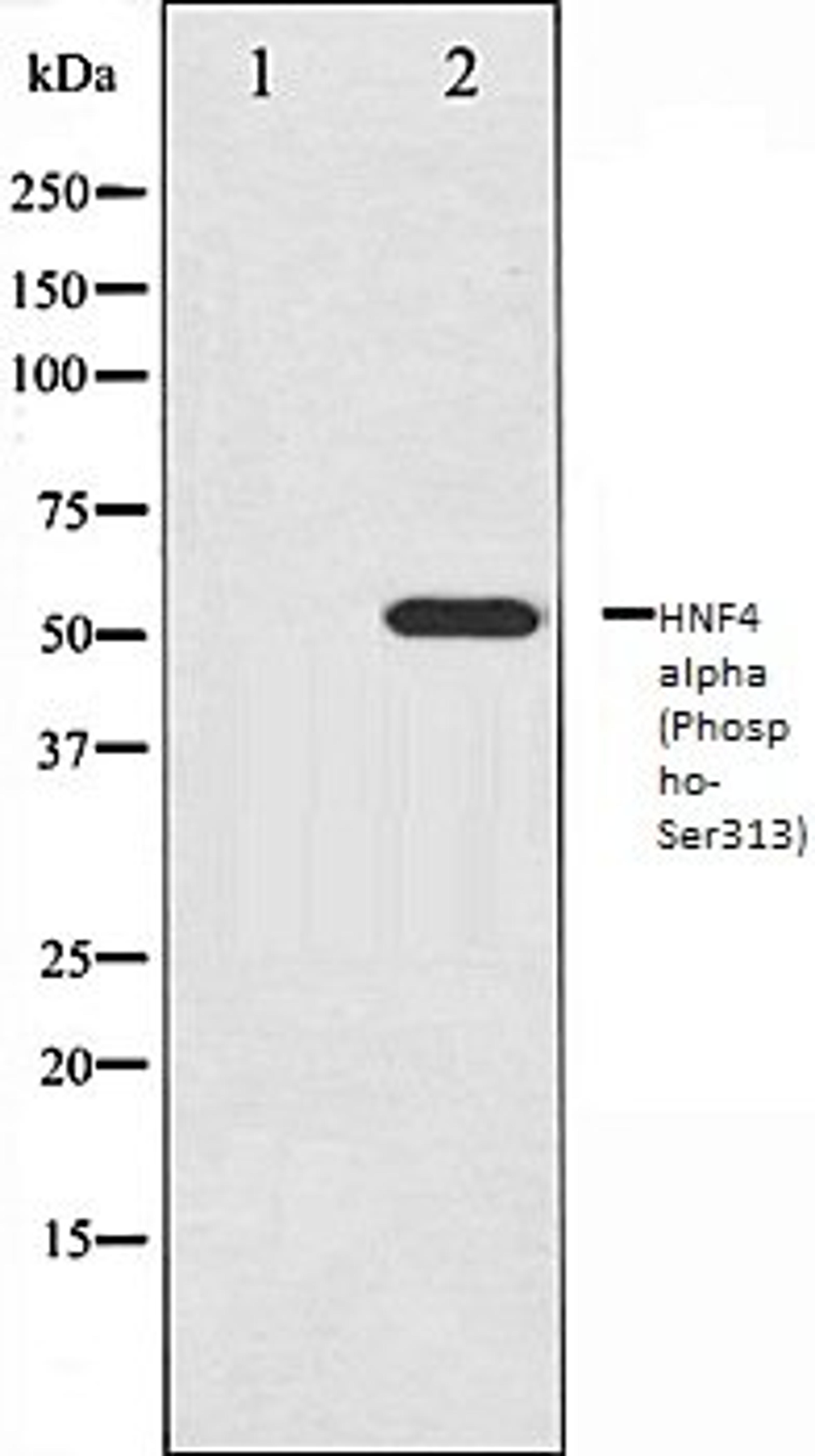 Western blot analysis of HuvEc whole cell lysates using HNF4 alpha (Phospho-Ser313) antibody, The lane on the left is treated with the antigen-specific peptide.