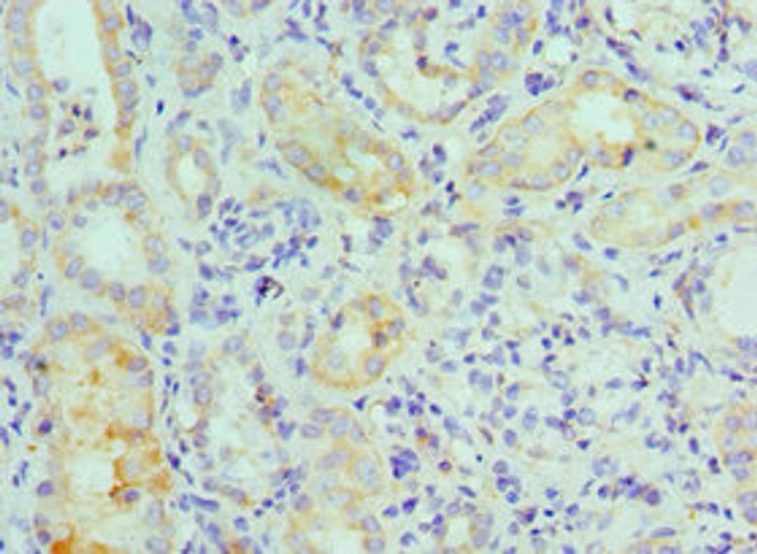 Immunohistochemistry of paraffin-embedded human kidney tissue using CSB-PA013465ESR1HU at dilution of 1:100