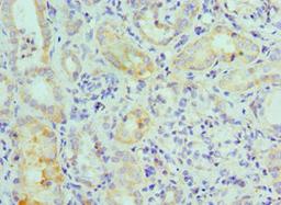 Immunohistochemistry of paraffin-embedded human kidney tissue using CSB-PA013465ESR1HU at dilution of 1:100