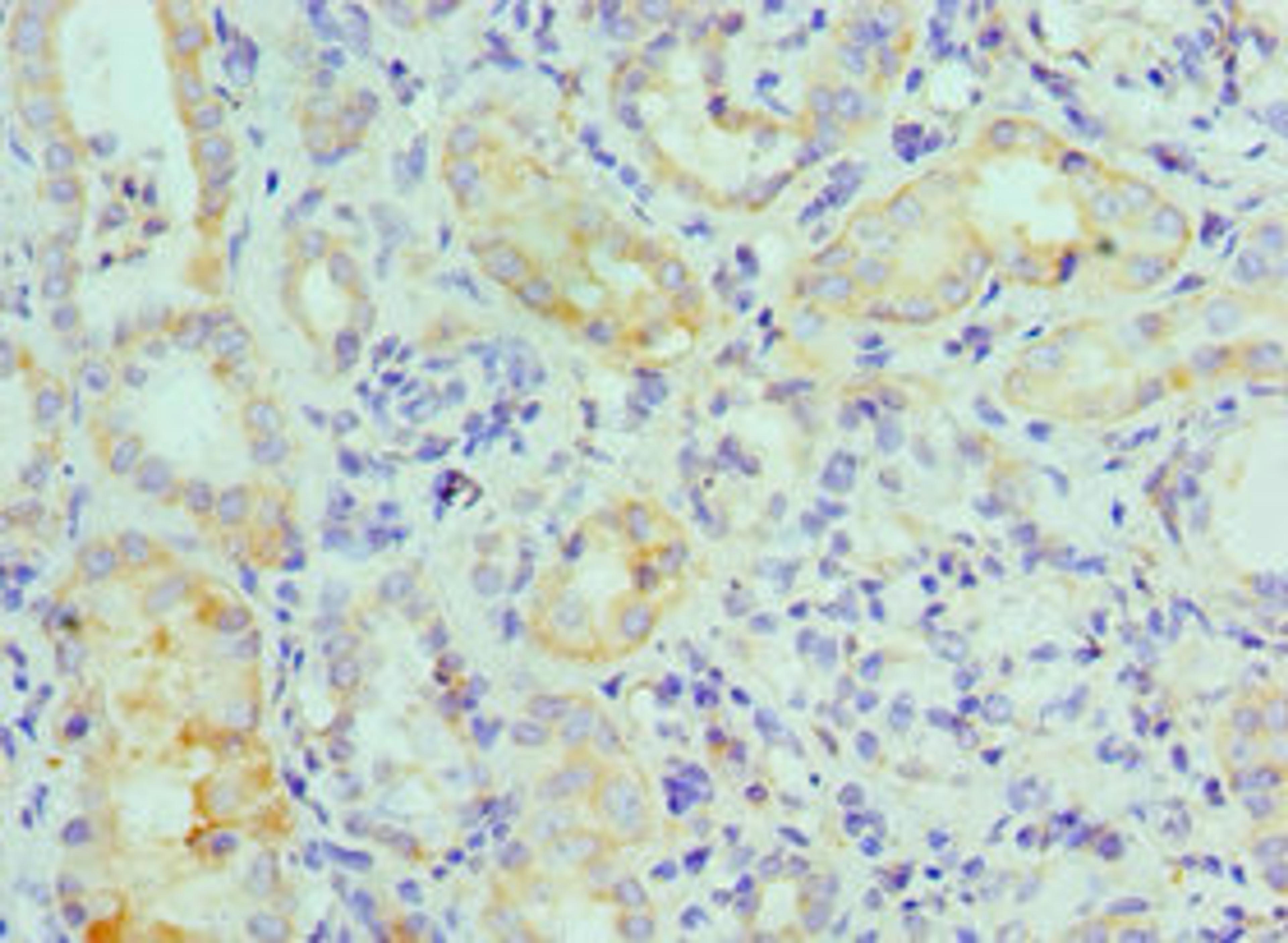 Immunohistochemistry of paraffin-embedded human kidney tissue using CSB-PA013465ESR1HU at dilution of 1:100