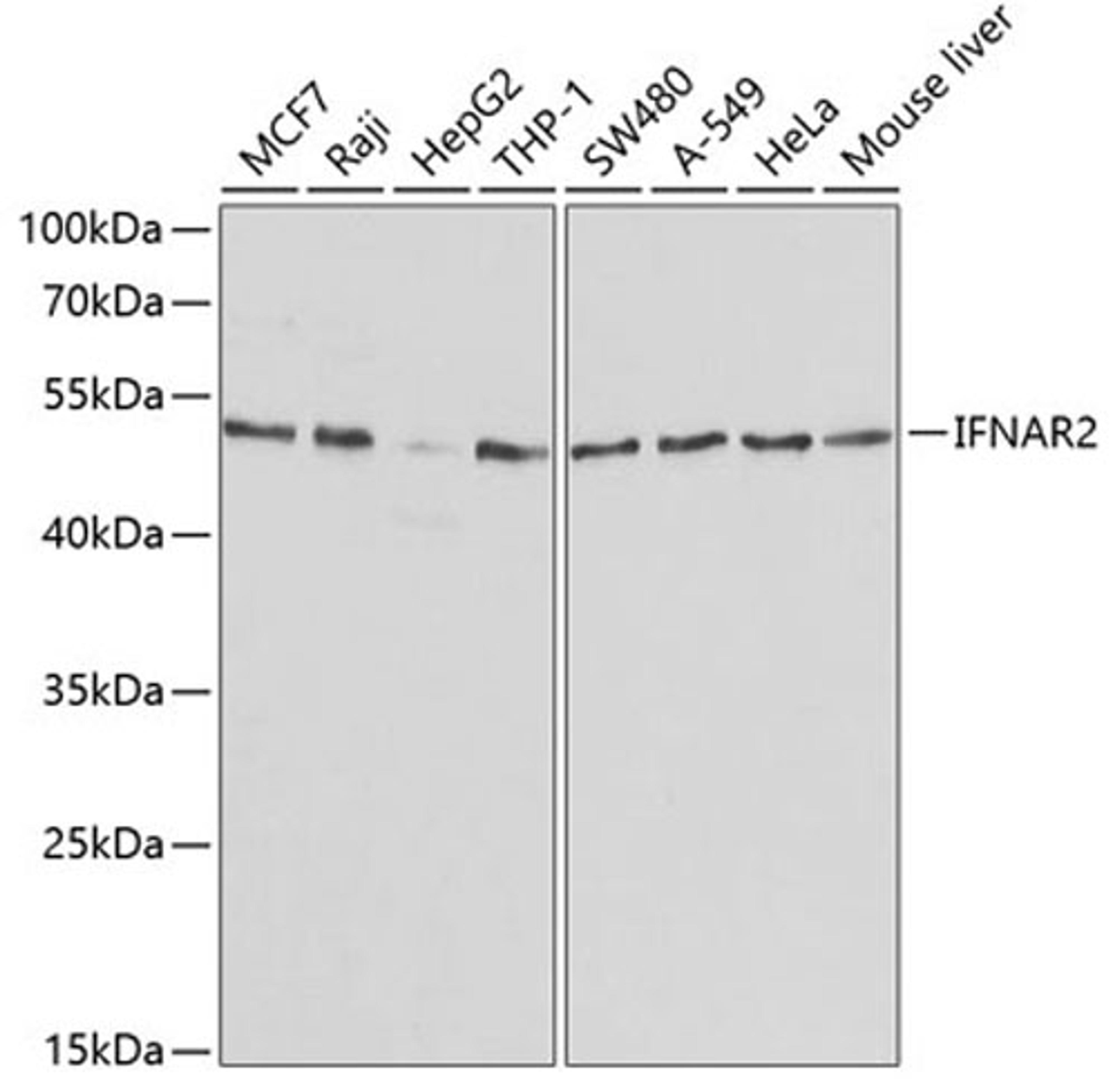 Western blot - IFNAR2 antibody (A1769)