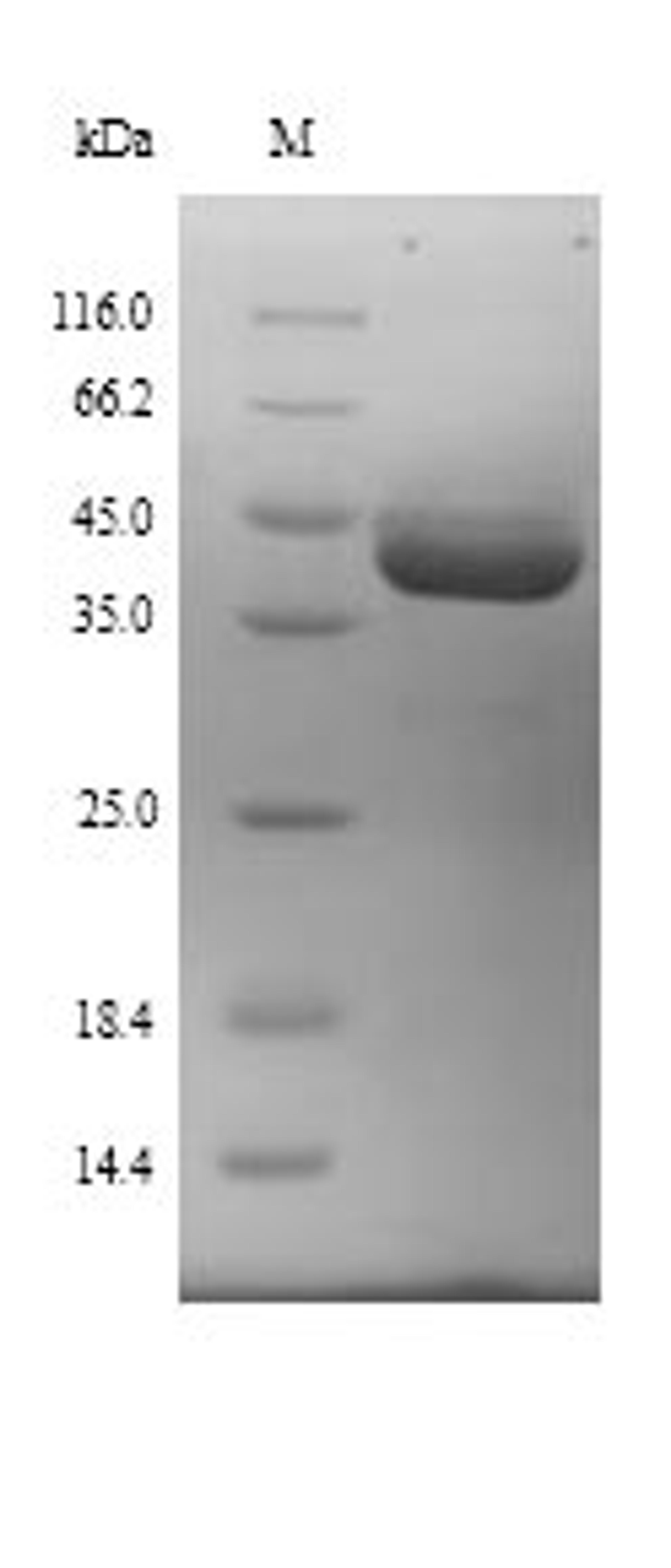 (Tris-Glycine gel) Discontinuous SDS-PAGE (reduced) with 5% enrichment gel and 15% separation gel.