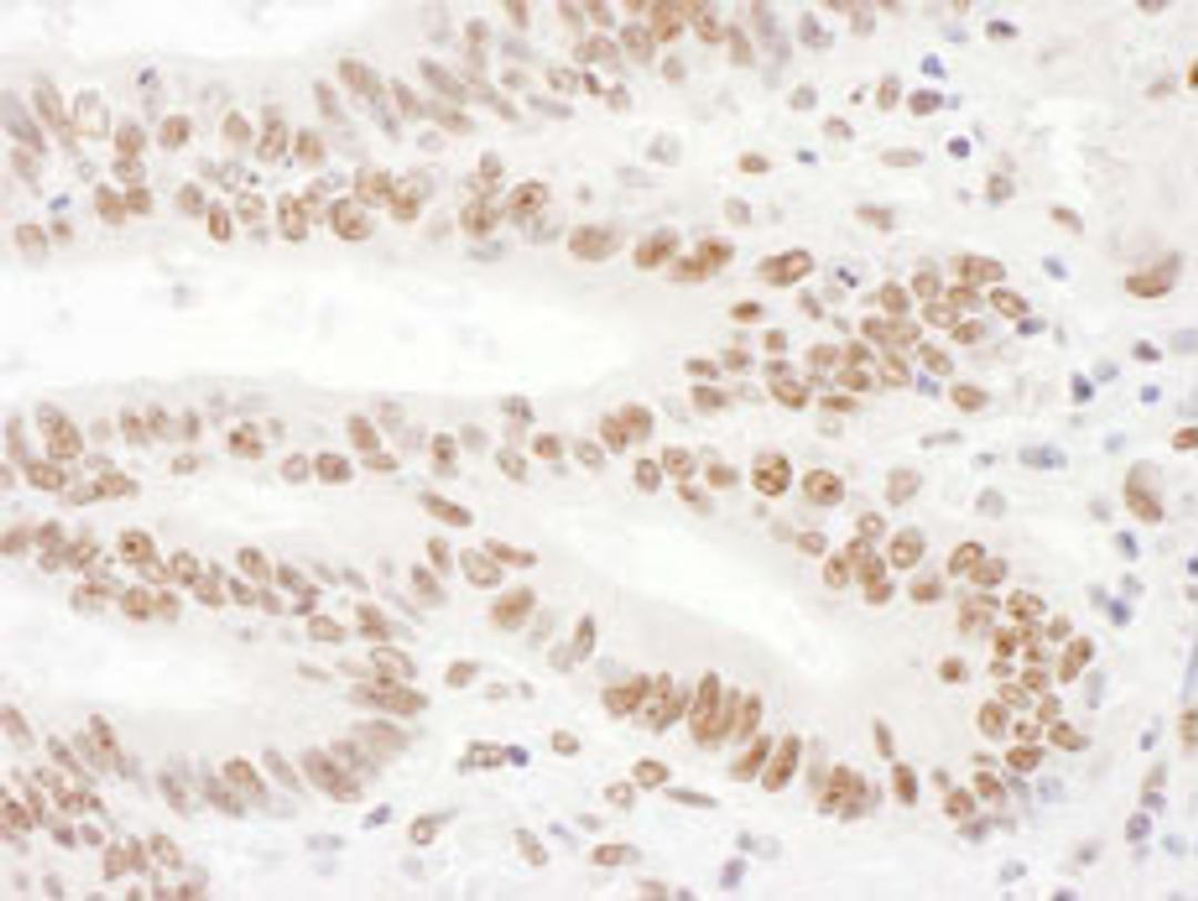 Detection of human KSRP by immunohistochemistry.