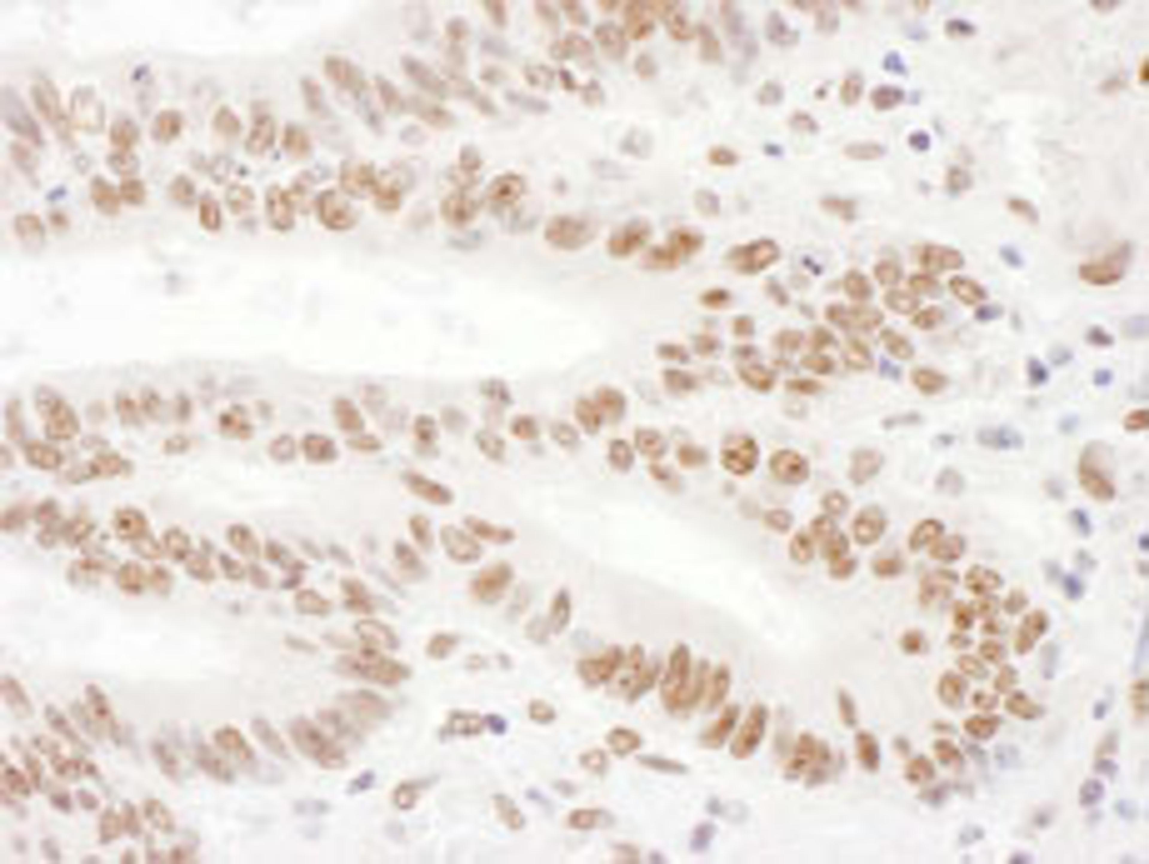 Detection of human KSRP by immunohistochemistry.