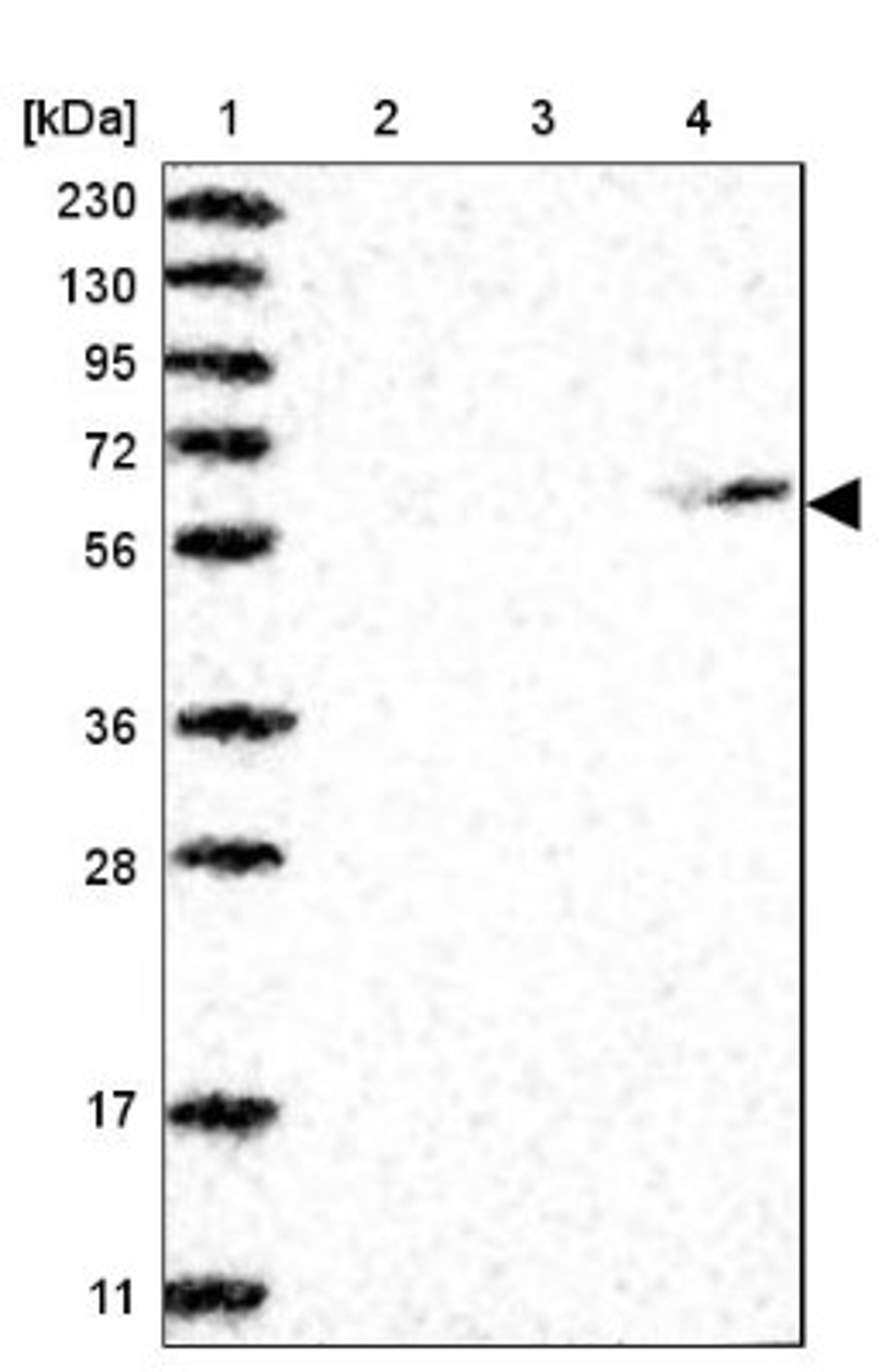 Western Blot: MDH1B Antibody [NBP1-83564] - Lane 1: Marker [kDa] 230, 130, 95, 72, 56, 36, 28, 17, 11<br/>Lane 2: Human cell line RT-4<br/>Lane 3: Human cell line U-251MG sp<br/>Lane 4: Human plasma (IgG/HSA depleted)