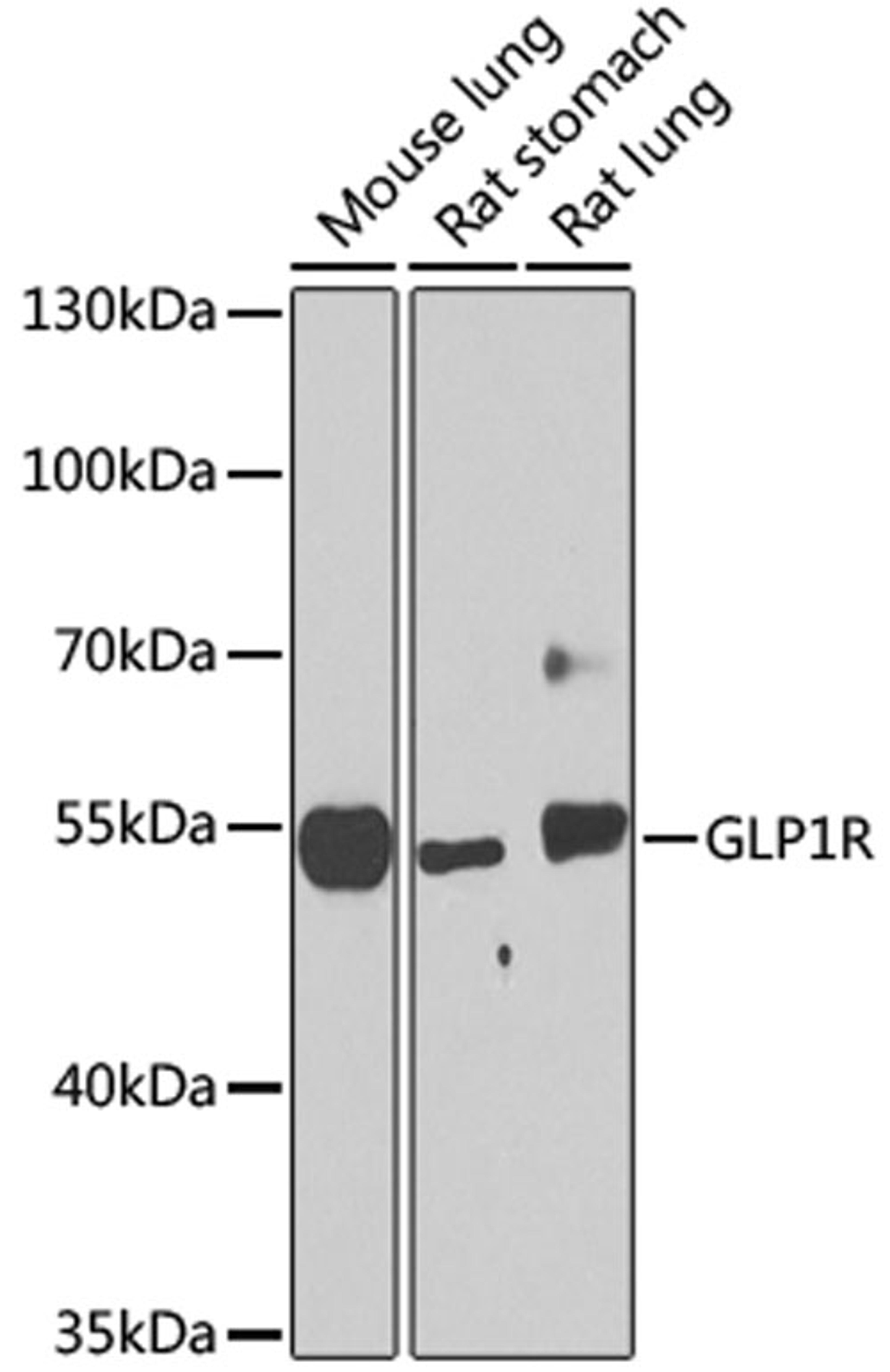 Western blot - GLP1R antibody (A8547)