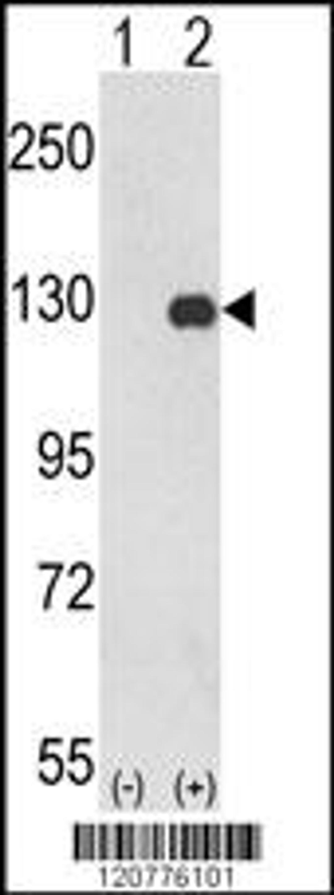 Western blot analysis of PTK2 using rabbit polyclonal PTK2 Antibody using 293 cell lysates (2 ug/lane) either nontransfected (Lane 1) or transiently transfected with the PTK2 gene (Lane 2).