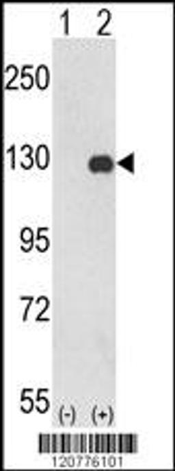 Western blot analysis of PTK2 using rabbit polyclonal PTK2 Antibody using 293 cell lysates (2 ug/lane) either nontransfected (Lane 1) or transiently transfected with the PTK2 gene (Lane 2).