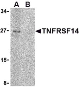 Western blot analysis of TNFRSF14 in Raji cell lysate with TNFRSF14 antibody at 2 μg/mL in (A) the absence and (B) the presence of blocking peptide.