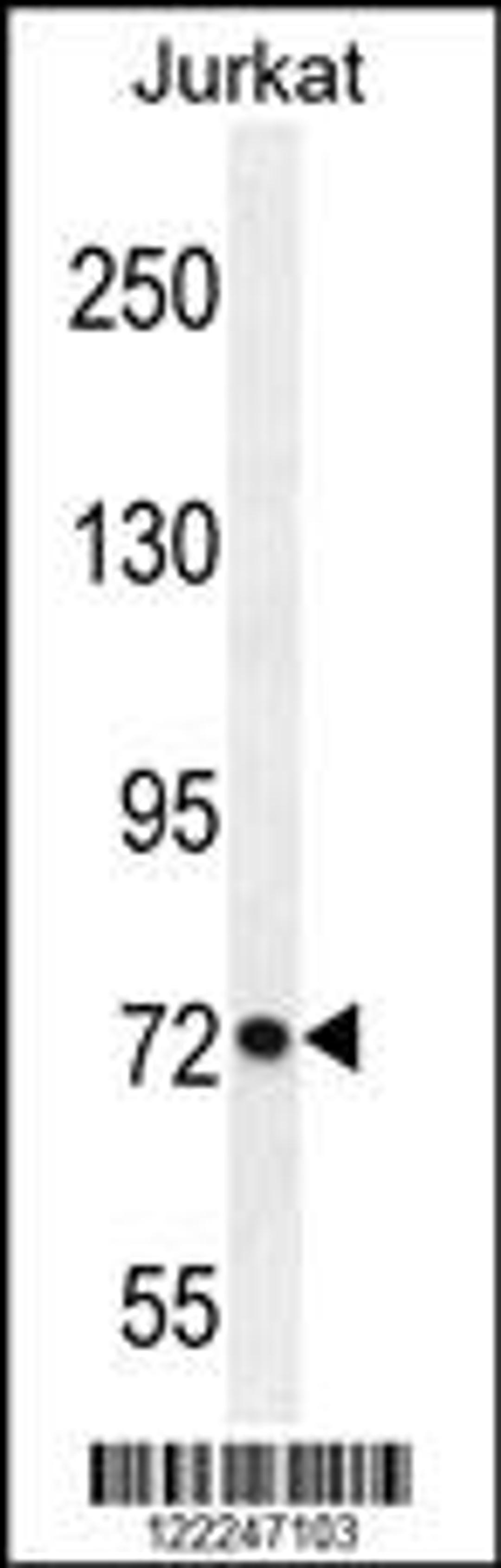 Western blot analysis in Jurkat cell line lysates (35ug/lane).