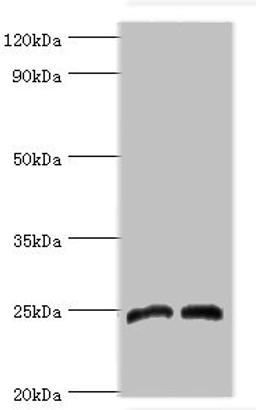 Western blot. All lanes: Dickkopf-related protein 4 antibody at 8ug/ml. Lane 1: Jurkat whole cell lysate. Lane 2: K562 whole cell lysate. Secondary. Goat polyclonal to rabbit IgG at 1/10000 dilution. Predicted band size: 25 kDa. Observed band size: 25 kDa. 