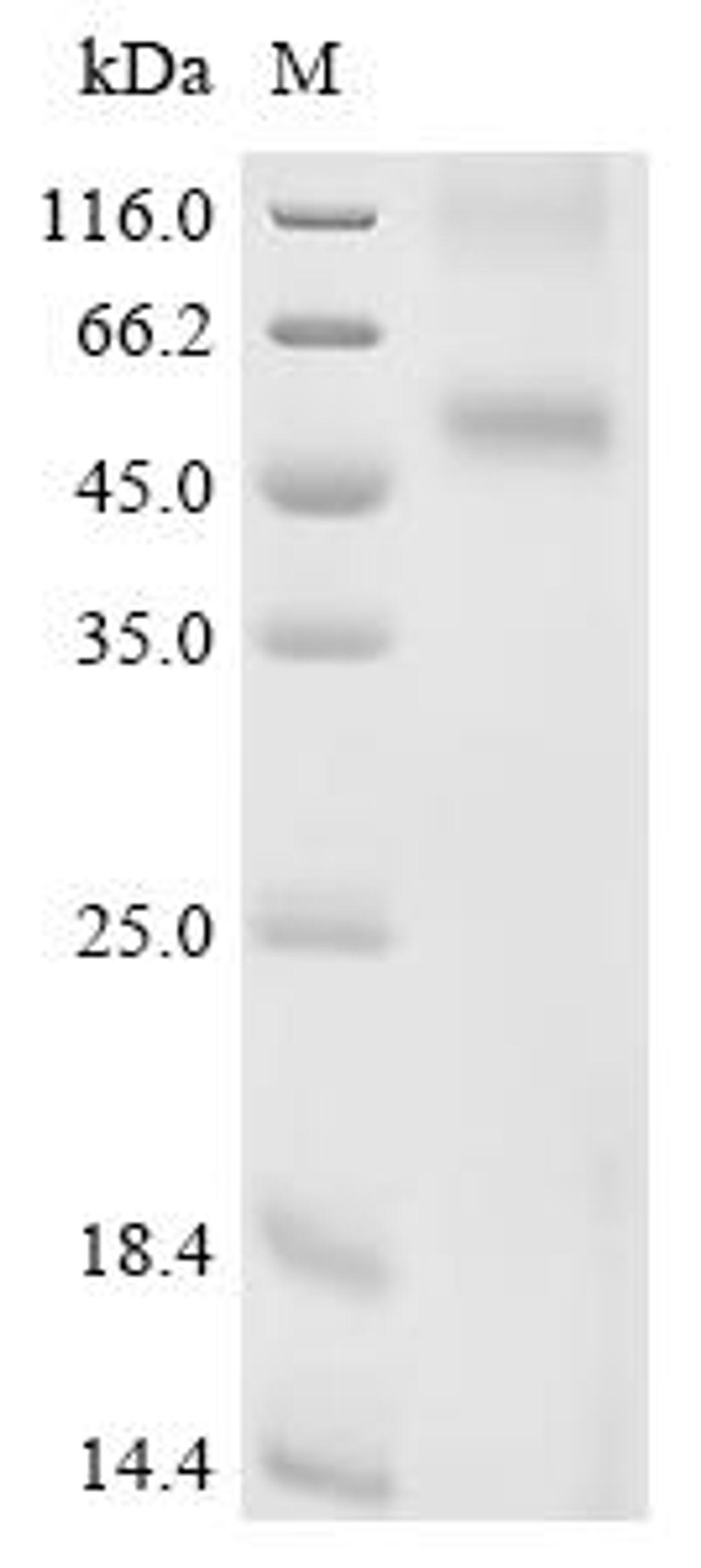 (Tris-Glycine gel) Discontinuous SDS-PAGE (reduced) with 5% enrichment gel and 15% separation gel.