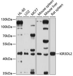 Western blot - KIR3DL2 antibody (A10117)