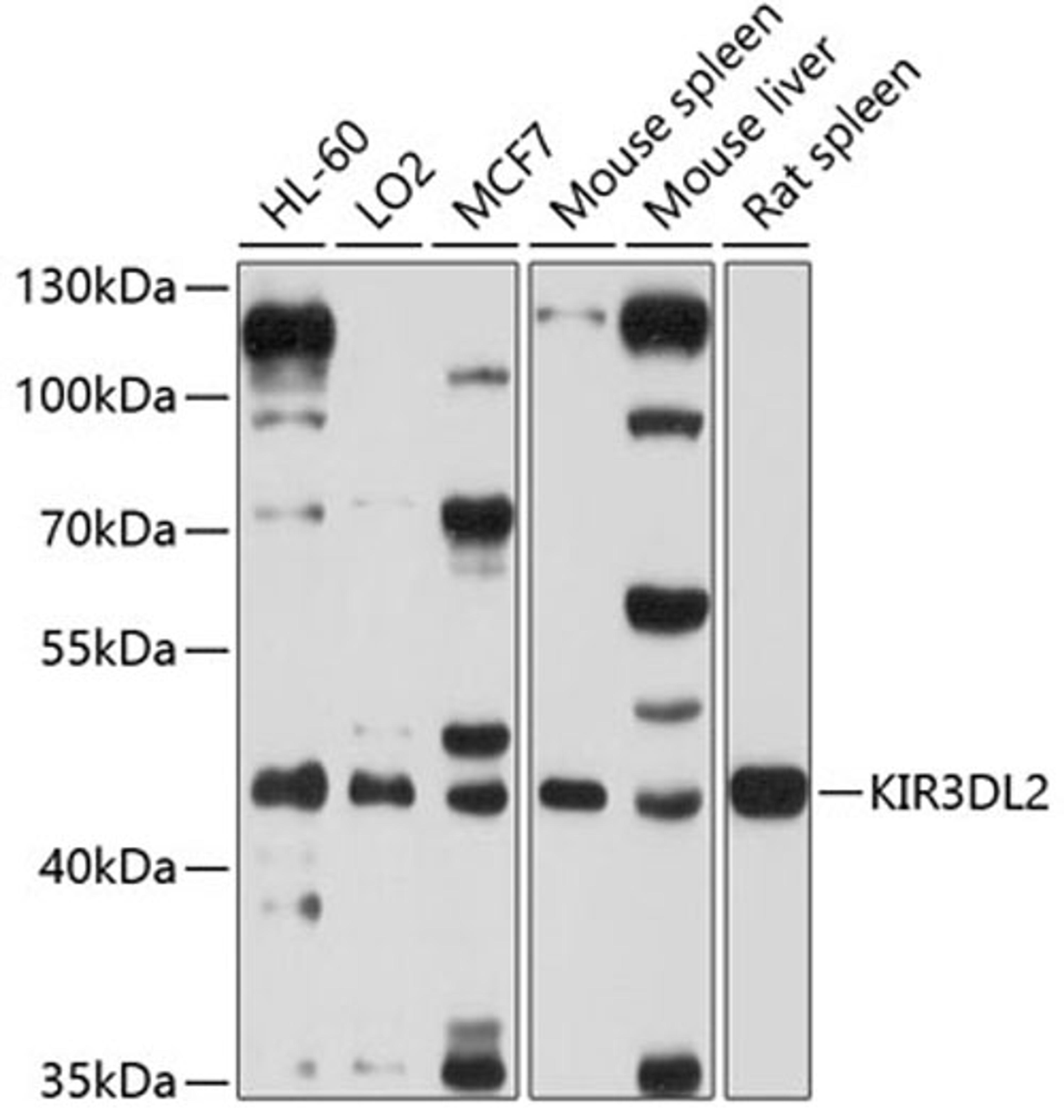 Western blot - KIR3DL2 antibody (A10117)