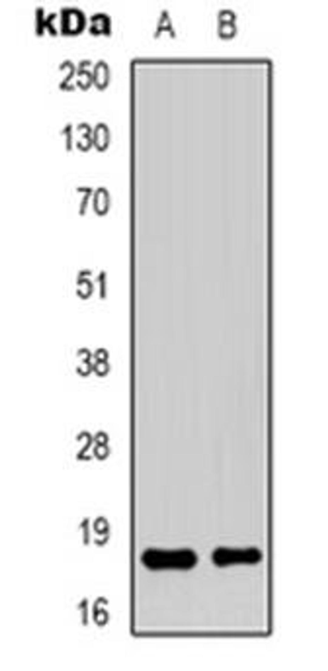 Western blot analysis of TCEAL1 expression in HepG2 (Lane 1), Hela (Lane 2) whole cell lysates using TCEAL1 antibody