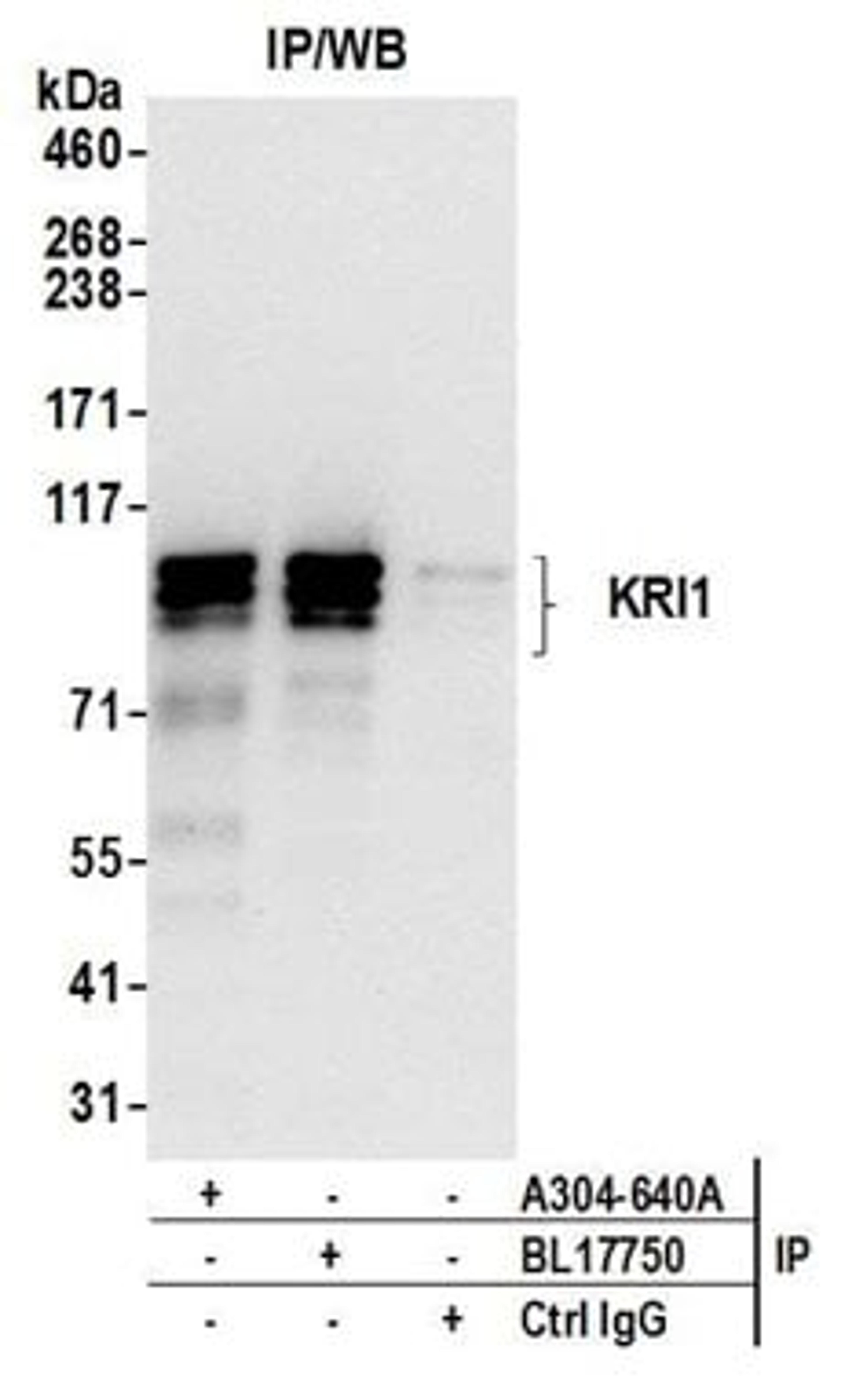 Detection of human KRI1 by western blot of immunoprecipitates.