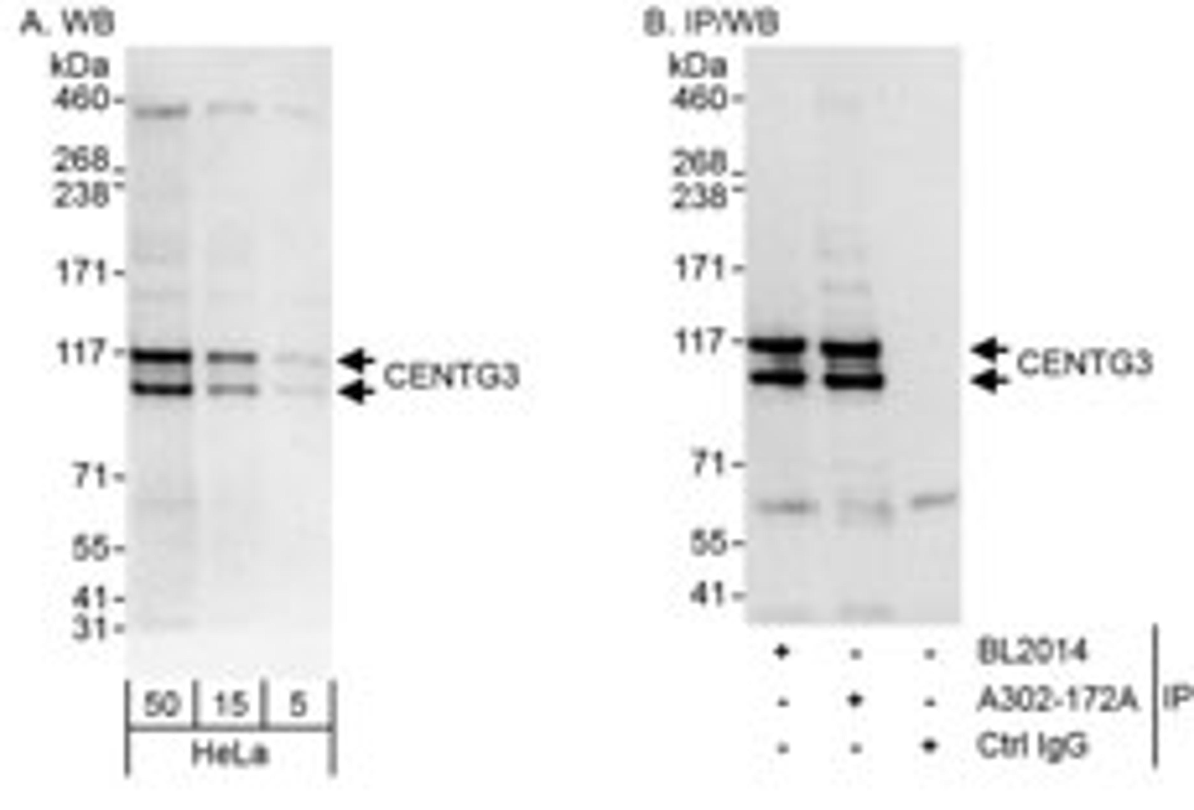 Detection of human CENTG3 by western blot and immunoprecipitation.