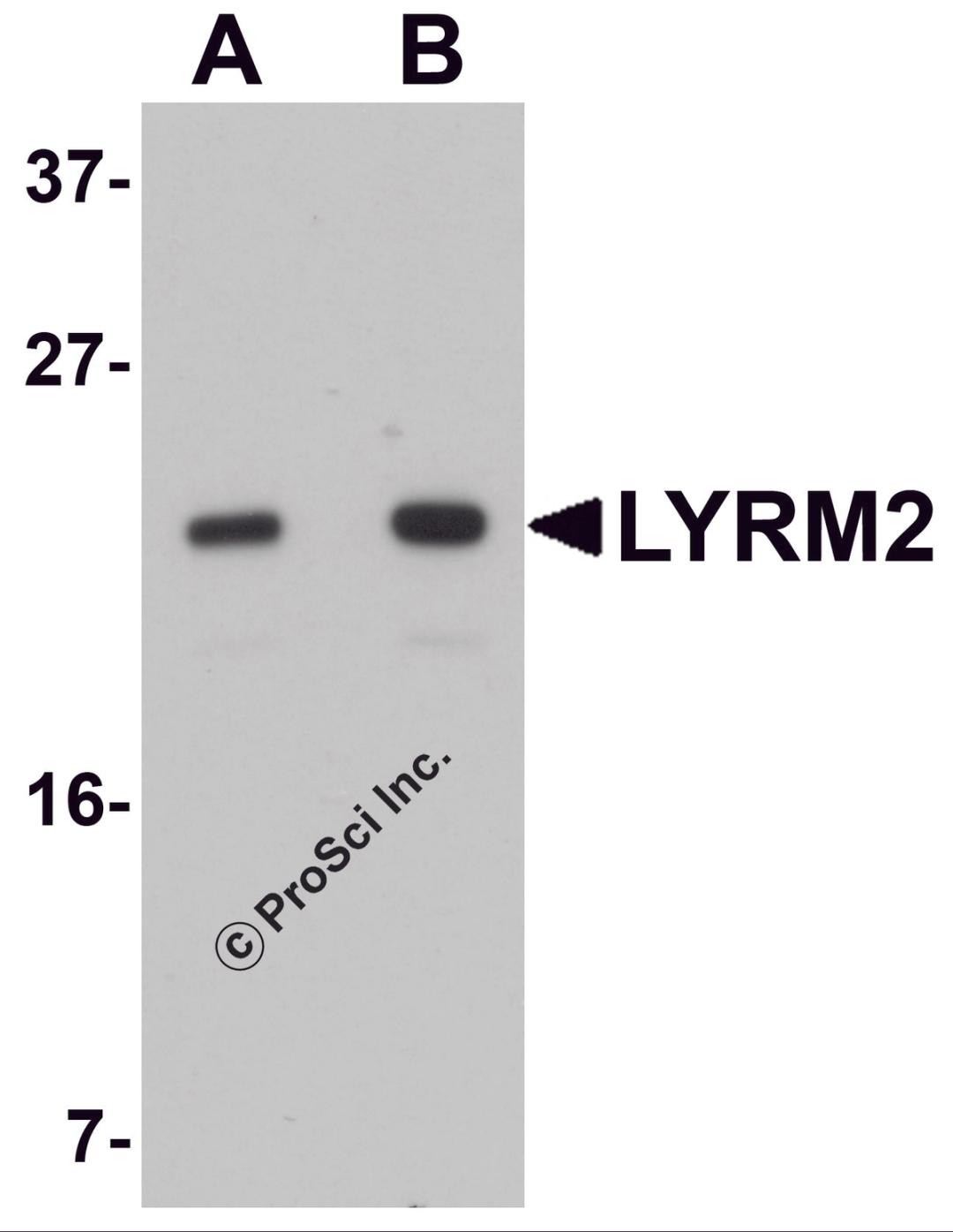 Western blot analysis of LYRM2 in A549 cell lysate with LYRM2 antibody at (A) 1 and (B) 2 μg/mL.