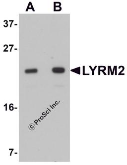 Western blot analysis of LYRM2 in A549 cell lysate with LYRM2 antibody at (A) 1 and (B) 2 μg/mL.