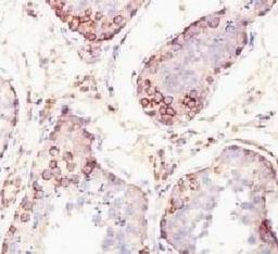 Formalin-fixed, paraffin-embedded human testis stained with MAGE-1 antibody (SPM282).