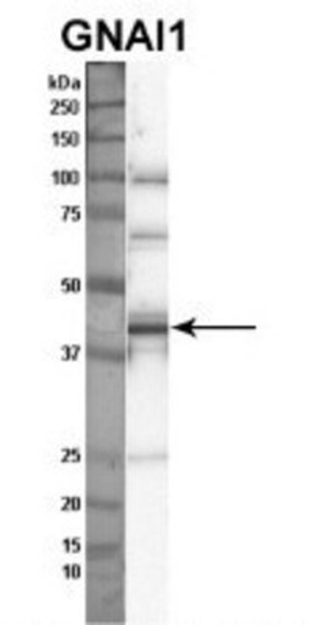 Western Blot: G protein alpha inhibitor 1 Antibody [NBP1-52926] - Sample Type: Nthy-ori cell lysate (50ug) Primary Dilution: 1:1000 Secondary Antibody: anti-rabbit HRP Secondary Dilution: 1:2000