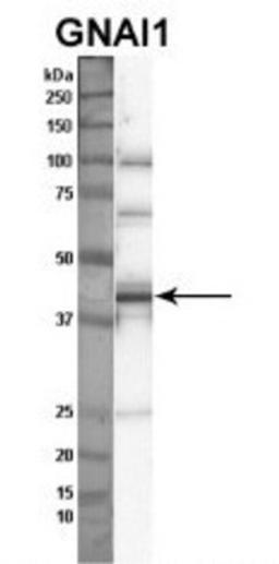 Western Blot: G protein alpha inhibitor 1 Antibody [NBP1-52926] - Sample Type: Nthy-ori cell lysate (50ug) Primary Dilution: 1:1000 Secondary Antibody: anti-rabbit HRP Secondary Dilution: 1:2000