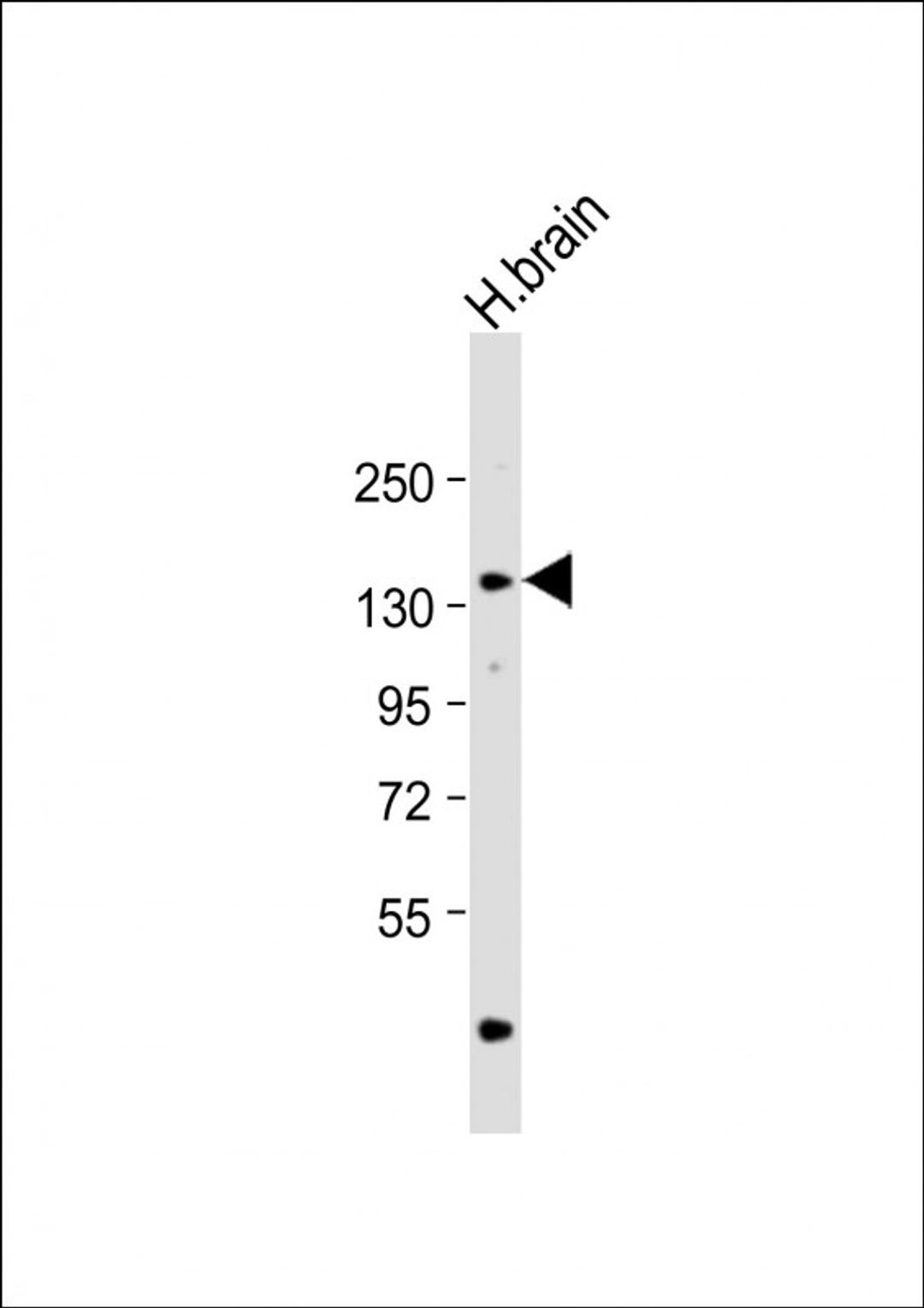 Western Blot at 1:1000 dilution + human brain lysate Lysates/proteins at 20 ug per lane.