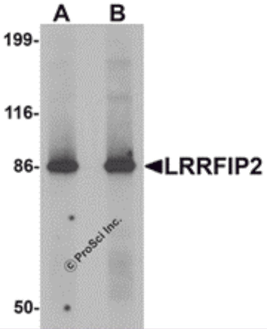 Western blot analysis of LRRFIP2 in rat colon tissue lysate with LRRFIP2 antibody at (A) 0.5 and (B) 1 &#956;g/mL.