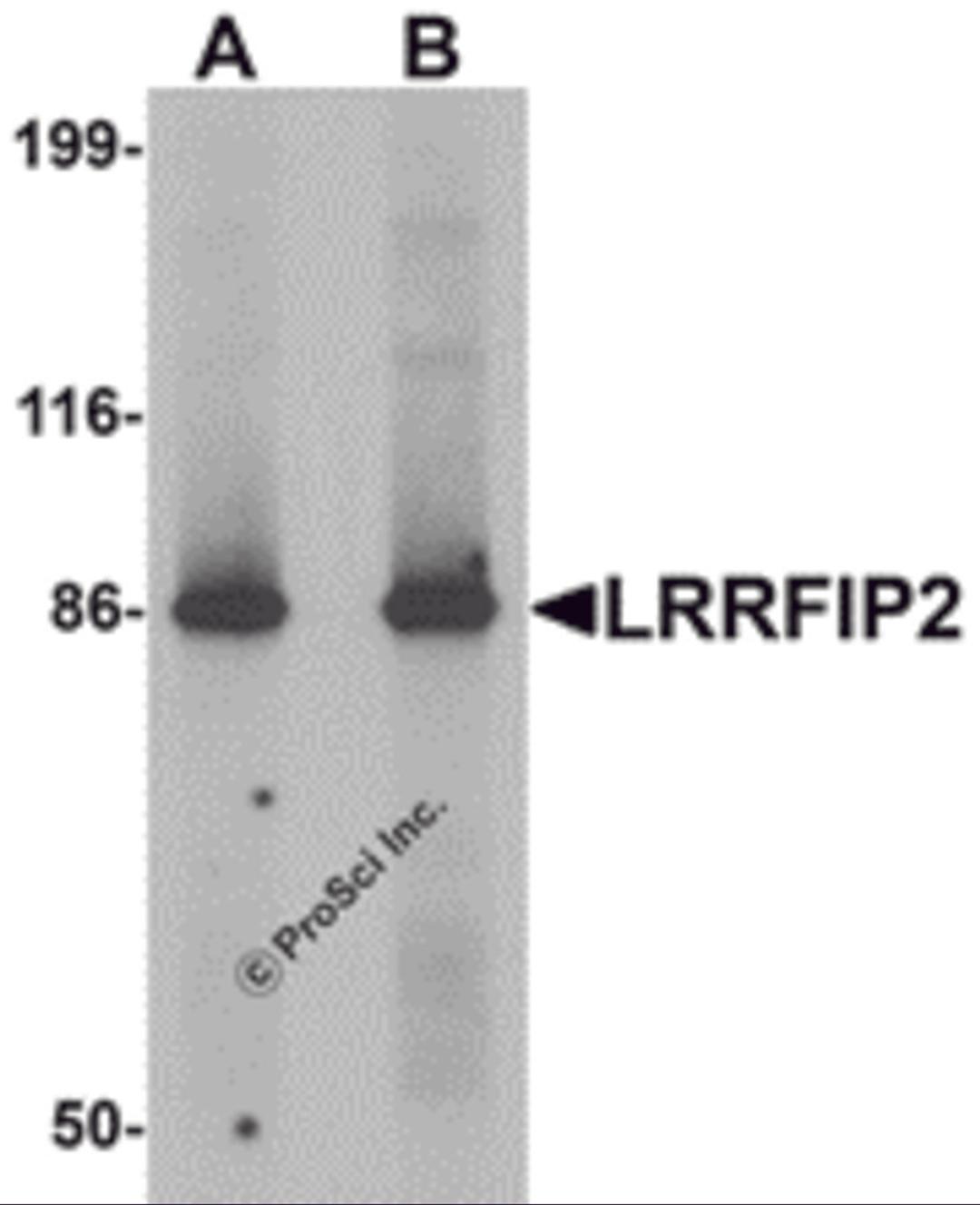 Western blot analysis of LRRFIP2 in rat colon tissue lysate with LRRFIP2 antibody at (A) 0.5 and (B) 1 μg/mL.