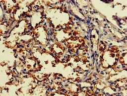 Immunohistochemistry of paraffin-embedded human lung tissue using CSB-PA006593LA01HU at dilution of 1:100
