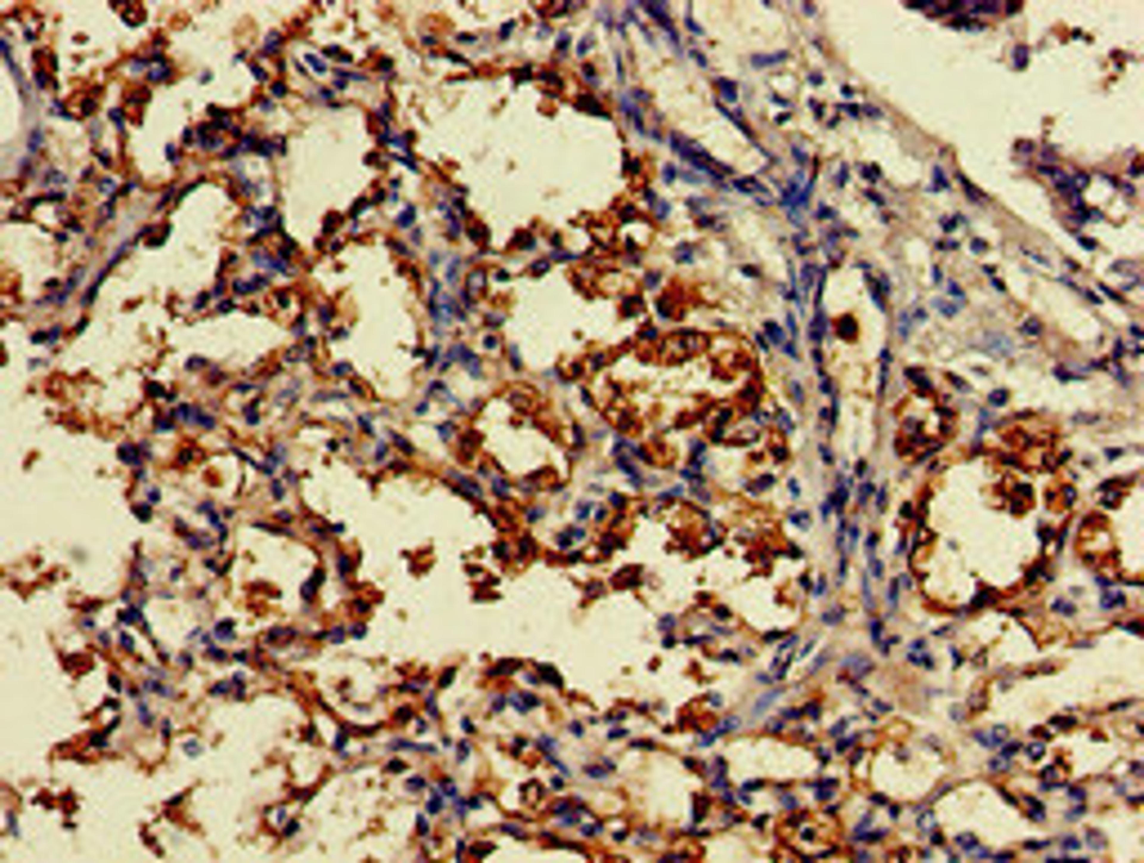 Immunohistochemistry of paraffin-embedded human lung tissue using CSB-PA006593LA01HU at dilution of 1:100