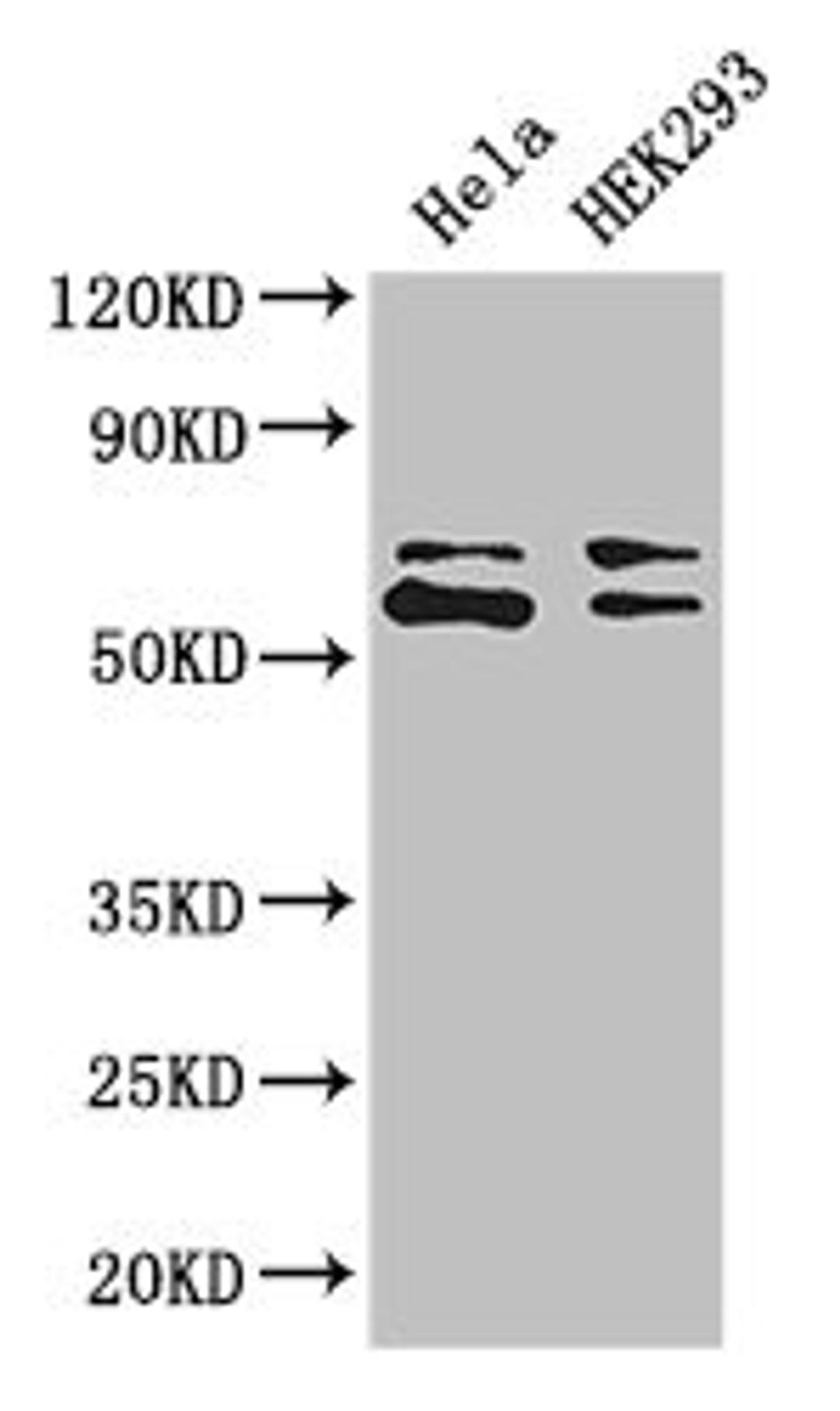 Western Blot. Positive WB detected in: Hela whole cell lysate, HEK293 whole cell lysate. All lanes: COASY antibody at 3.4ug/ml. Secondary. Goat polyclonal to rabbit IgG at 1/50000 dilution. Predicted band size: 63, 66 kDa. Observed band size: 63, 66 kDa.