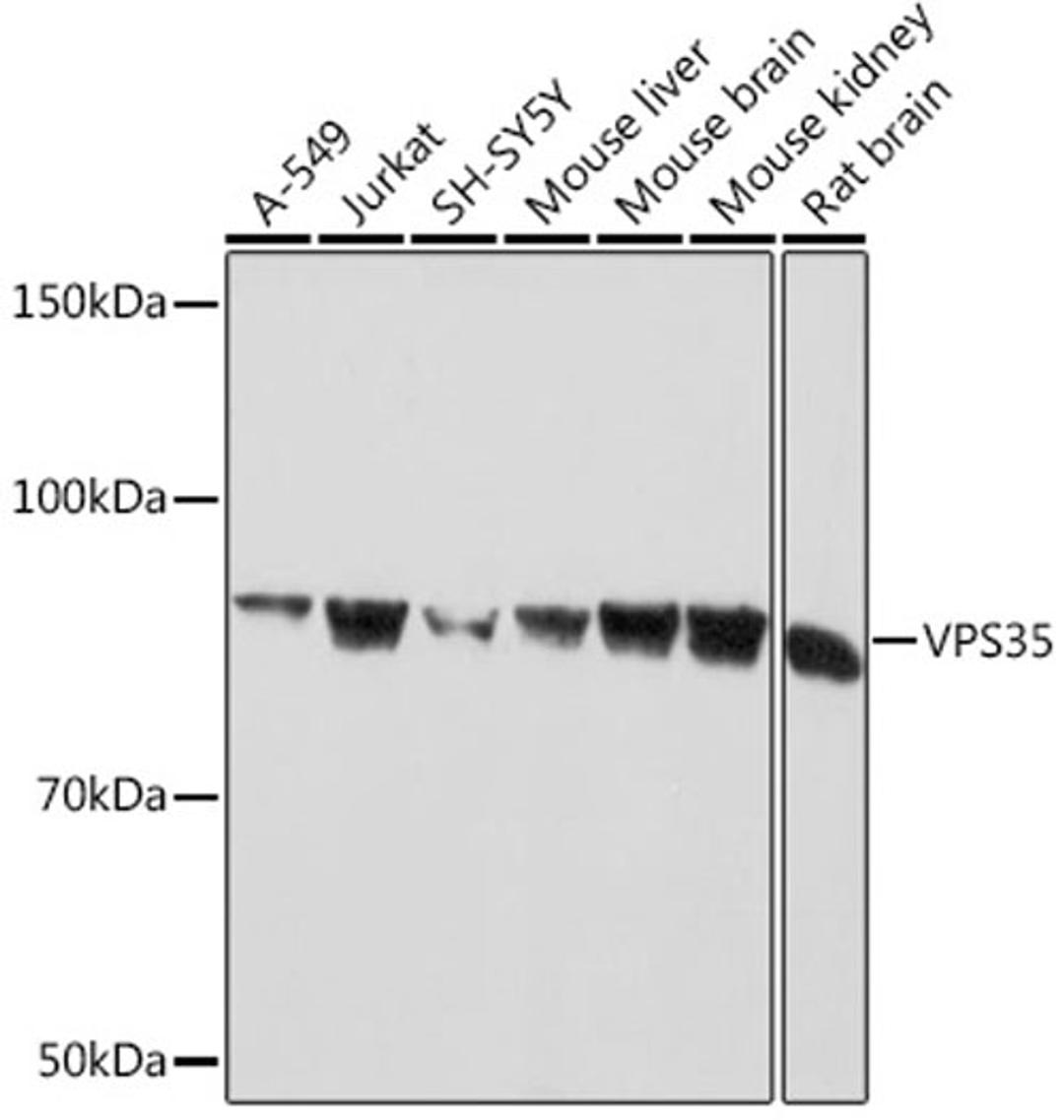 Western blot - VPS35 Rabbit mAb (A9278)