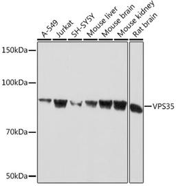 Western blot - VPS35 Rabbit mAb (A9278)