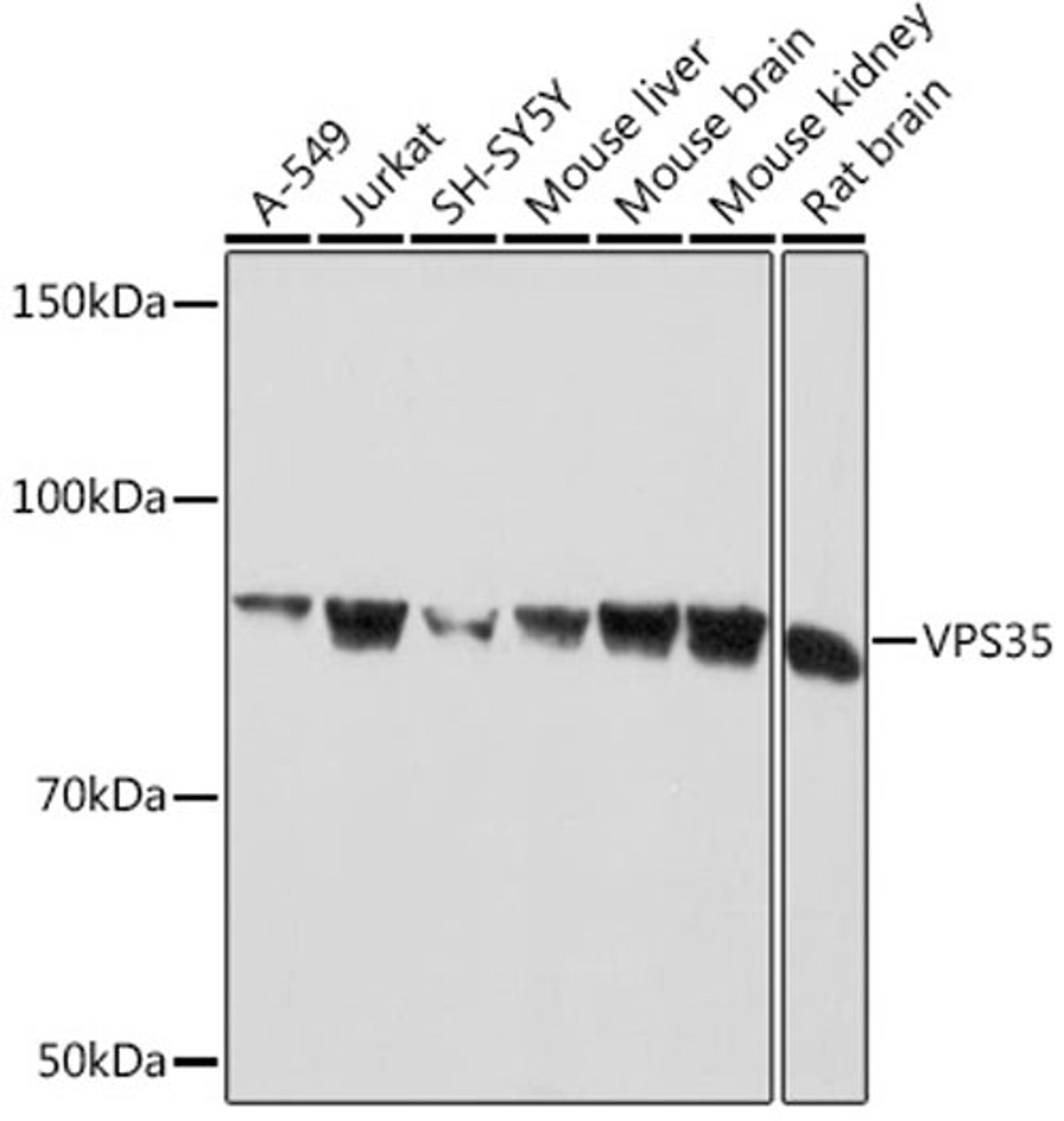 Western blot - VPS35 Rabbit mAb (A9278)