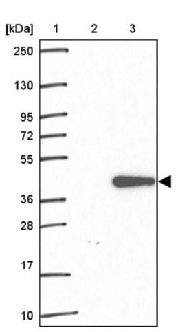 Western Blot: Exosome component 8 Antibody [NBP2-47466] - Lane 1: Marker [kDa] 250, 130, 95, 72, 55, 36, 28, 17, 10.  Lane 2: Negative control (vector only transfected HEK293T lysate).  Lane 3: Over-expression lysate (Co-expressed with a C-terminal myc-DDK tag (3.1 kDa) in mammalian HEK293T cells).