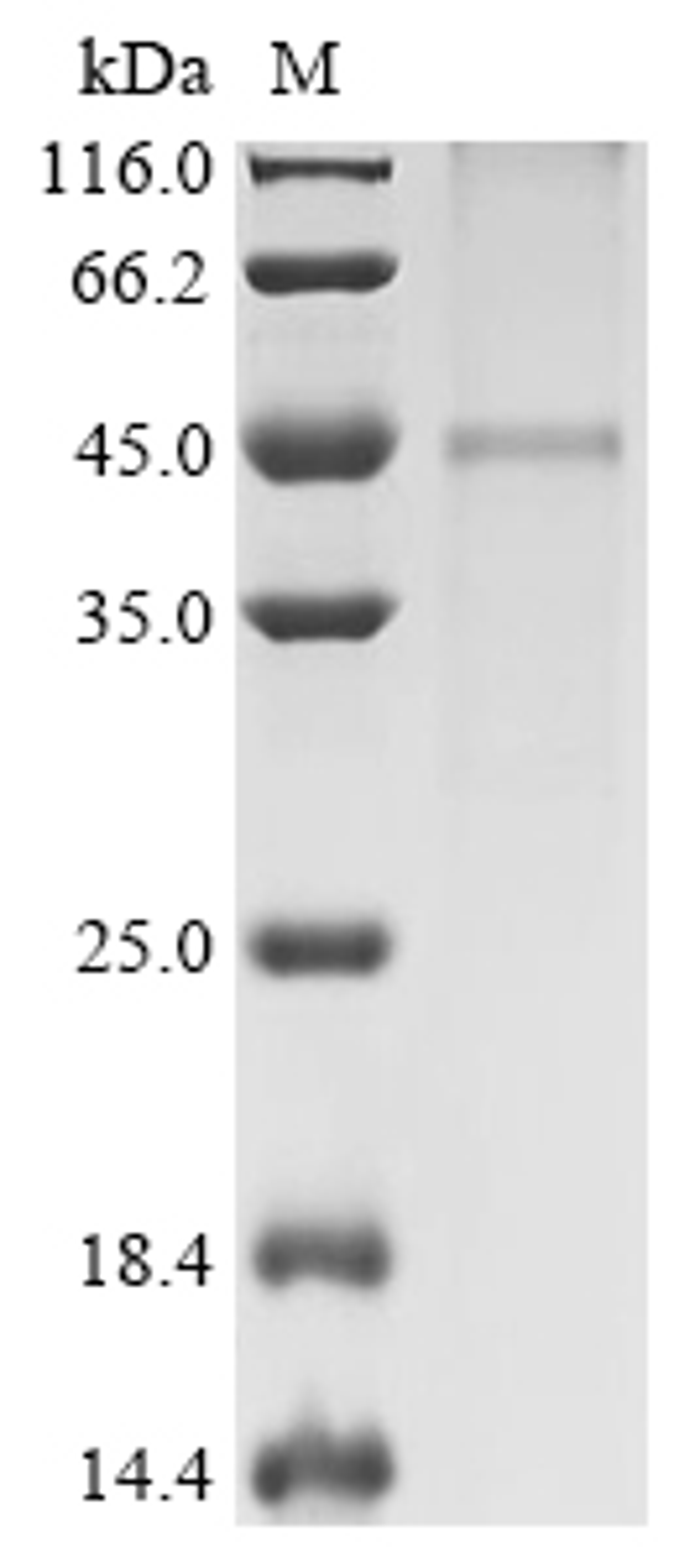 (Tris-Glycine gel) Discontinuous SDS-PAGE (reduced) with 5% enrichment gel and 15% separation gel.