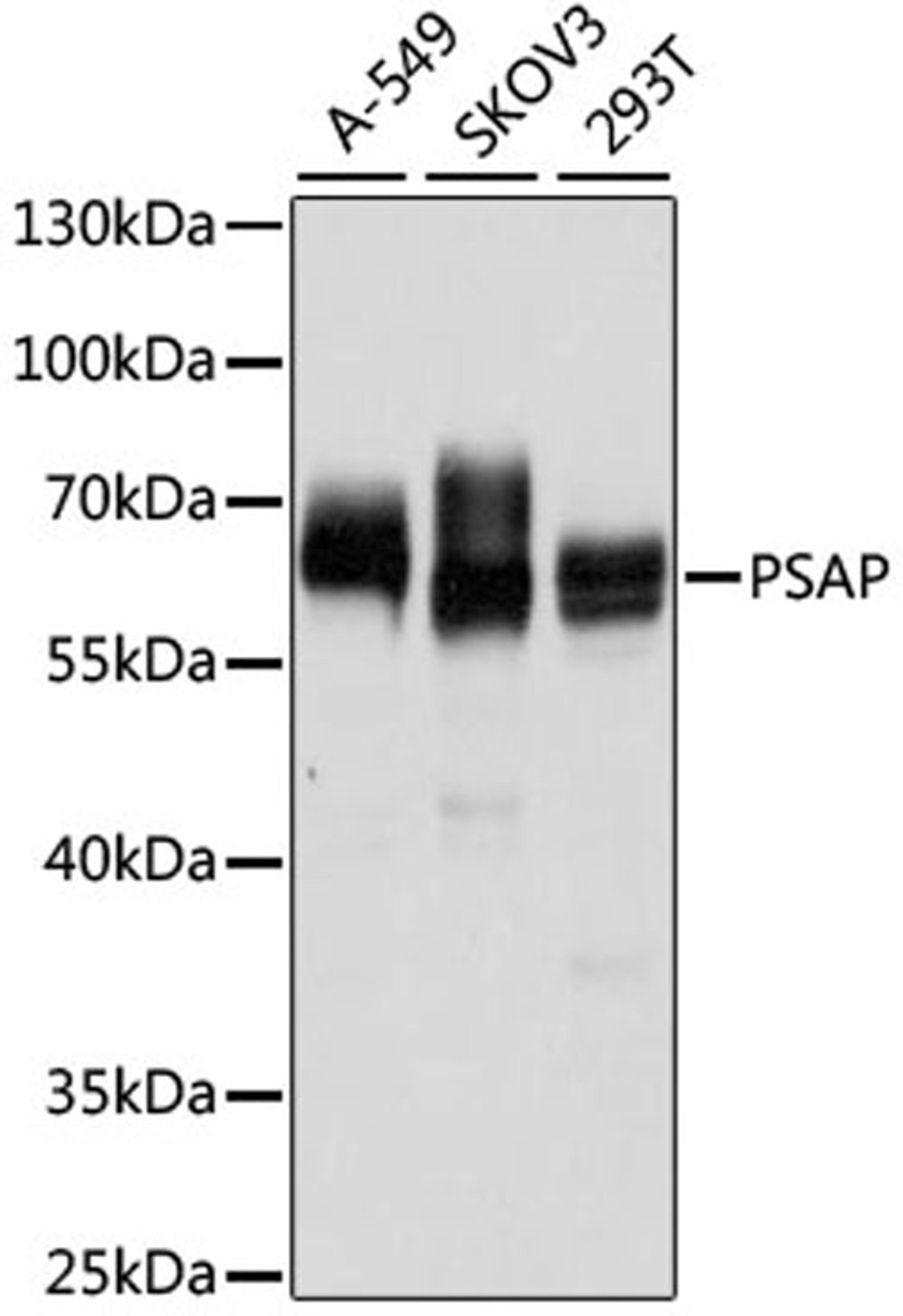 Western blot - PSAP antibody (A1819)