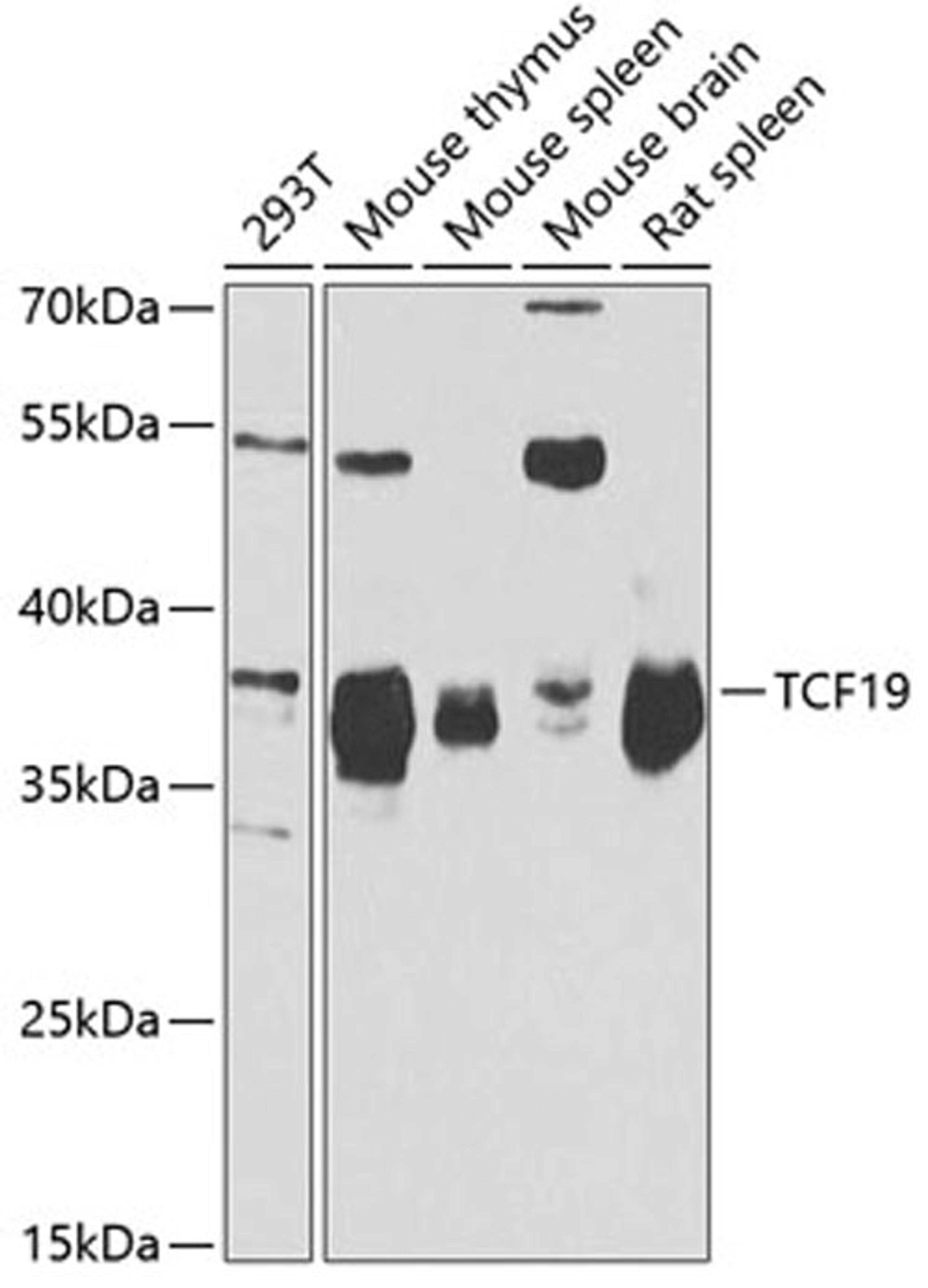 Western blot - TCF19 antibody (A6147)