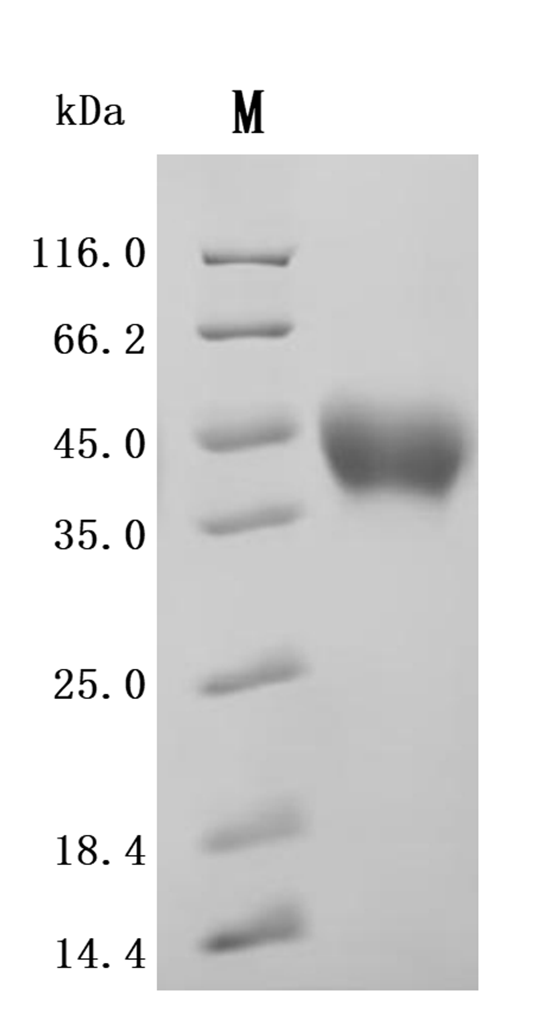 (Tris-Glycine gel) Discontinuous SDS-PAGE (reduced) with 5% enrichment gel and 15% separation gel.